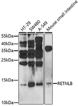 Western blot - RETNLB antibody (A17228)