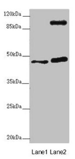 Western blot. All lanes: AURKA antibody at 2µg/ml. Lane 1: NIH/3T3 whole cell lysate. Lane 2: HT29 whole cell lysate. Secondary. Goat polyclonal to rabbit IgG at 1/10000 dilution. Predicted band size: 46 kDa. Observed band size: 46, 110 kDa