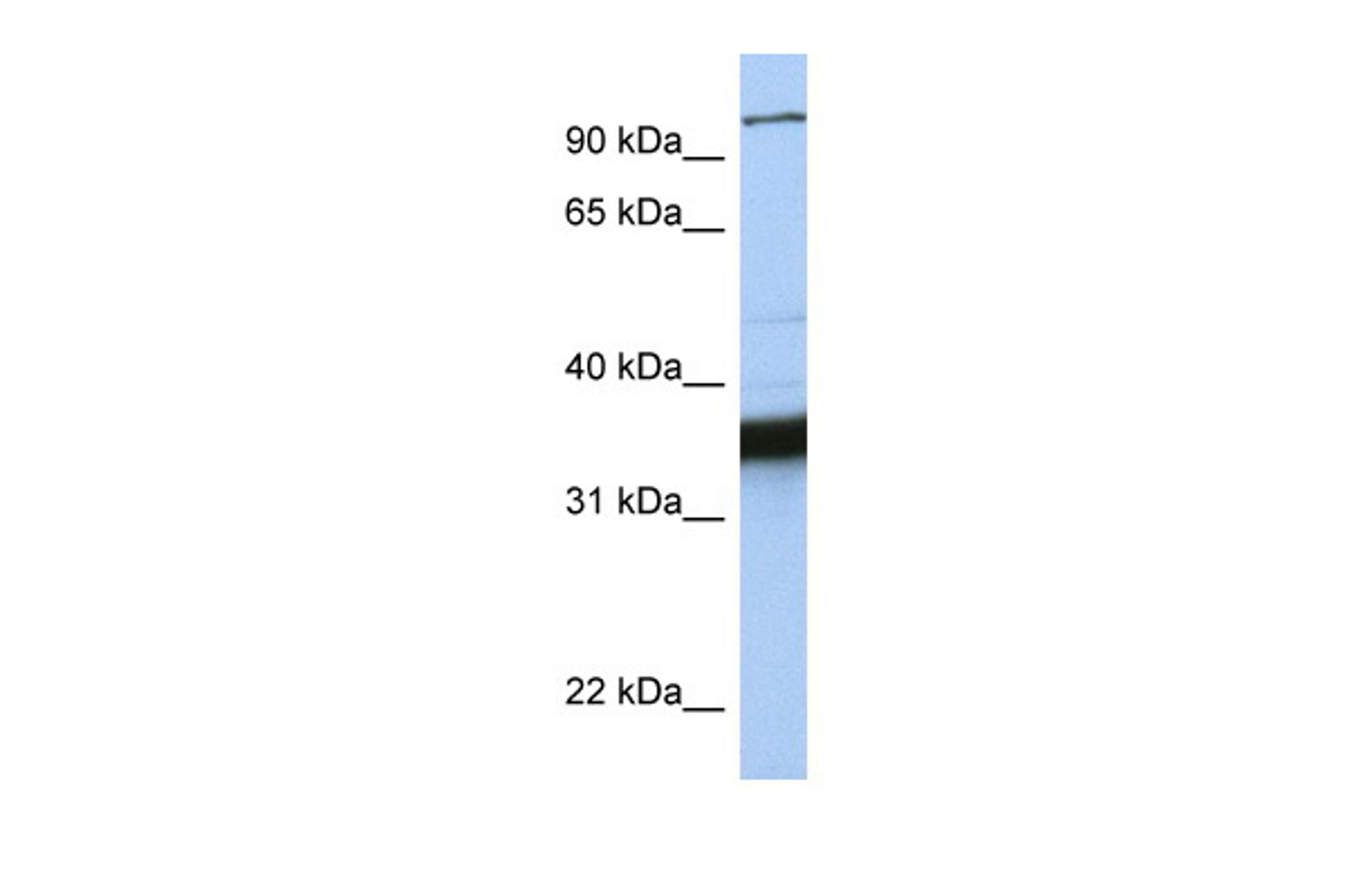 Antibody used in WB on Human MCF-7 at 0.2-1 ug/ml.