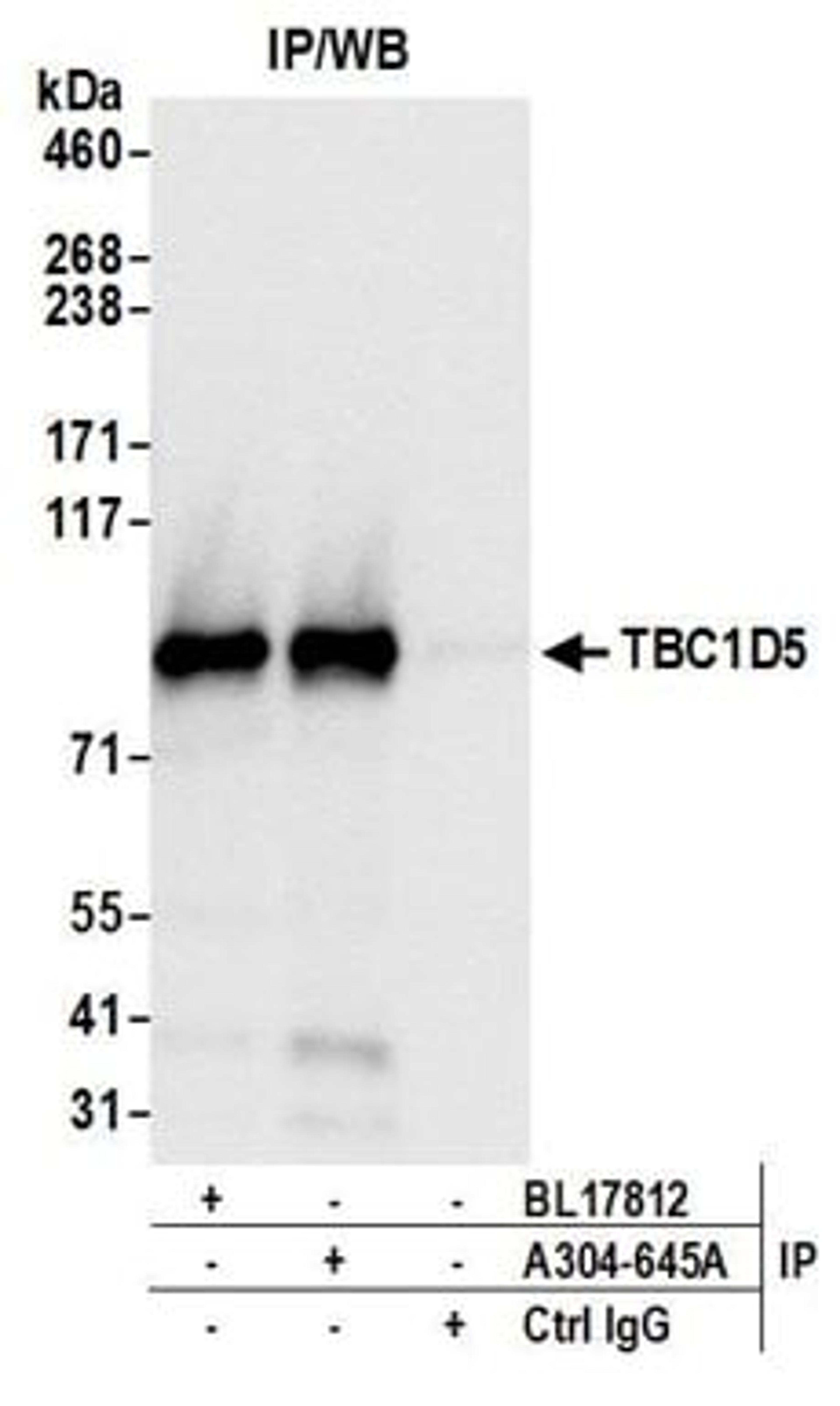 Detection of human TBC1D5 by western blot of immunoprecipitates.