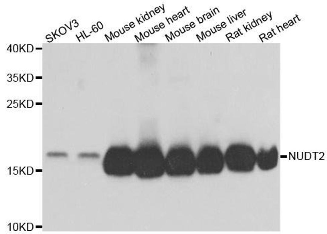 Western blot analysis of extracts of various cell lines using NUDT2 antibody