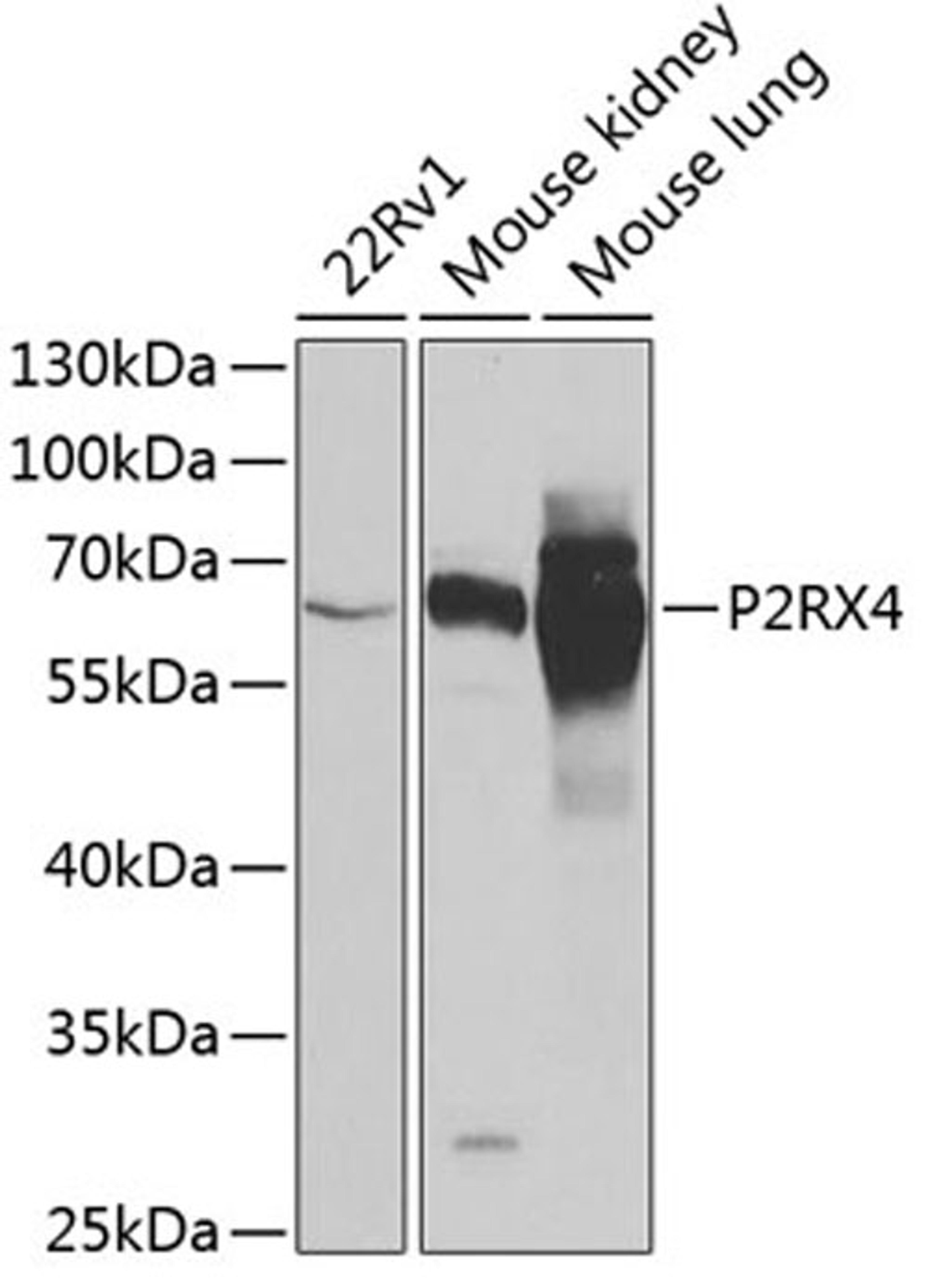 Western blot - P2RX4 antibody (A6682)