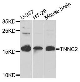 Western blot analysis of extracts of various cells using TNNC2 antibody