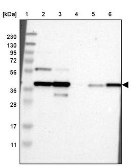 Western Blot: ENDOGL1 Antibody [NBP1-87950] - Lane 1: Marker [kDa] 230, 130, 95, 72, 56, 36, 28, 17, 11<br/>Lane 2: Human cell line RT-4<br/>Lane 3: Human cell line U-251MG sp<br/>Lane 4: Human plasma (IgG/HSA depleted)<br/>Lane 5: Human liver tissue<br/>Lane 6: Human tonsil tissue