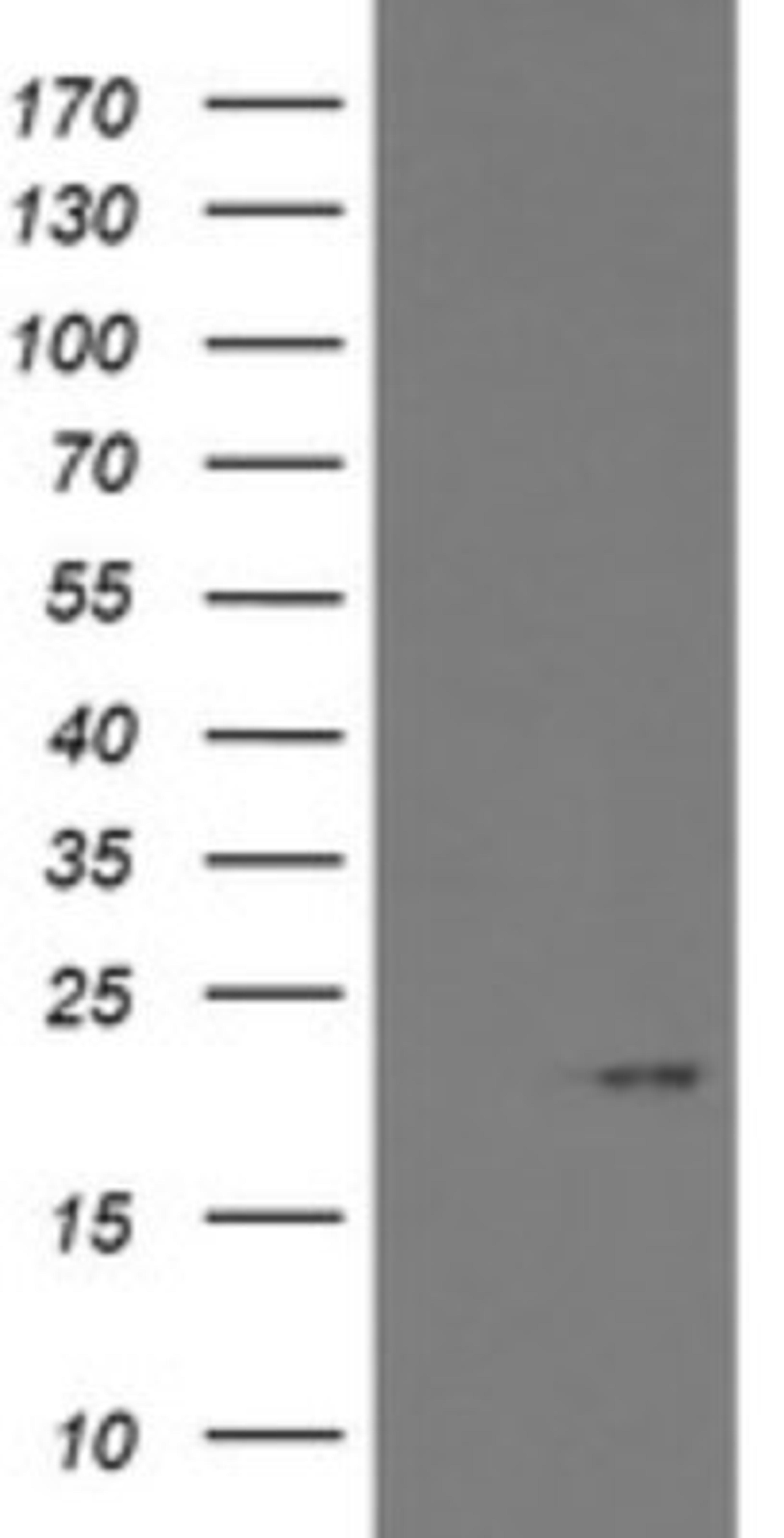 Western Blot: ARL2BP Antibody (1A10) [NBP2-46541] - Analysis of HEK293T cells were transfected with the pCMV6-ENTRY control (Left lane) or pCMV6-ENTRY ARL2BP .