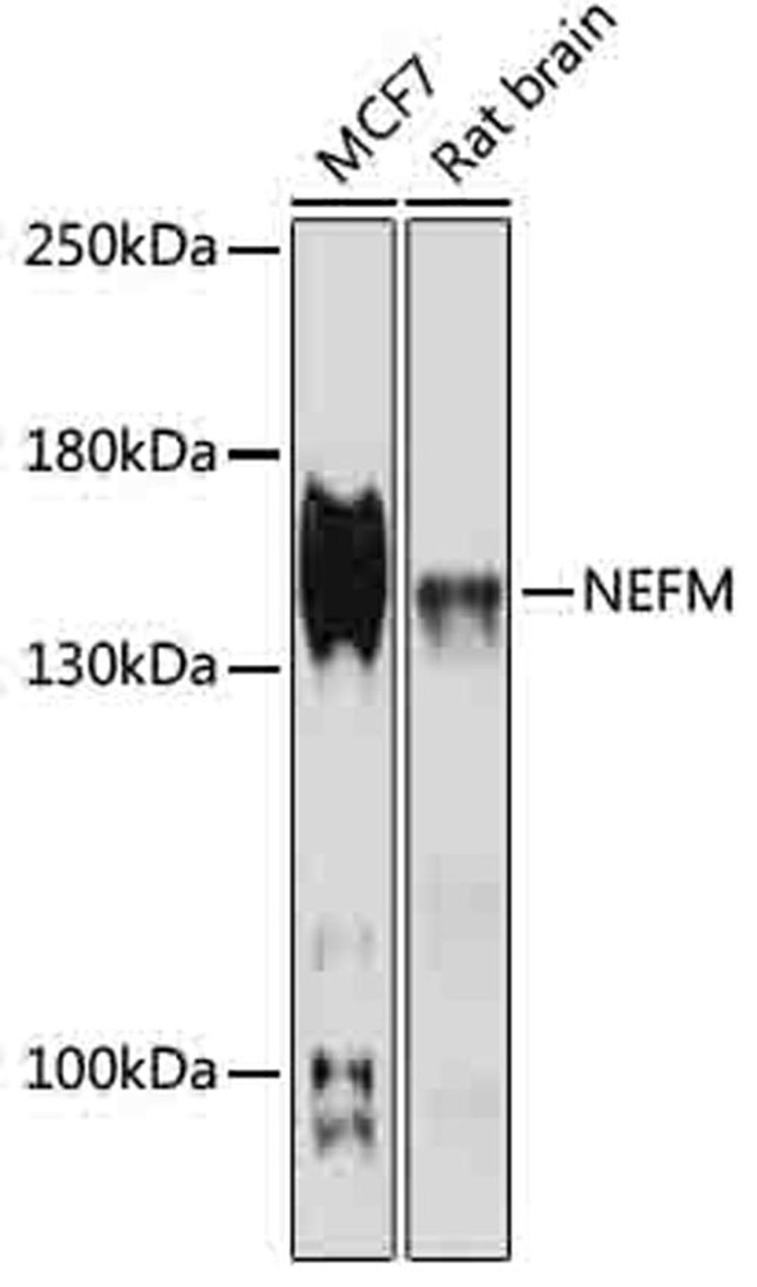 Western blot - NEFM antibody (A16405)