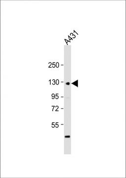 Western Blot at 1:1000 dilution + A431 whole cell lysate Lysates/proteins at 20 ug per lane.