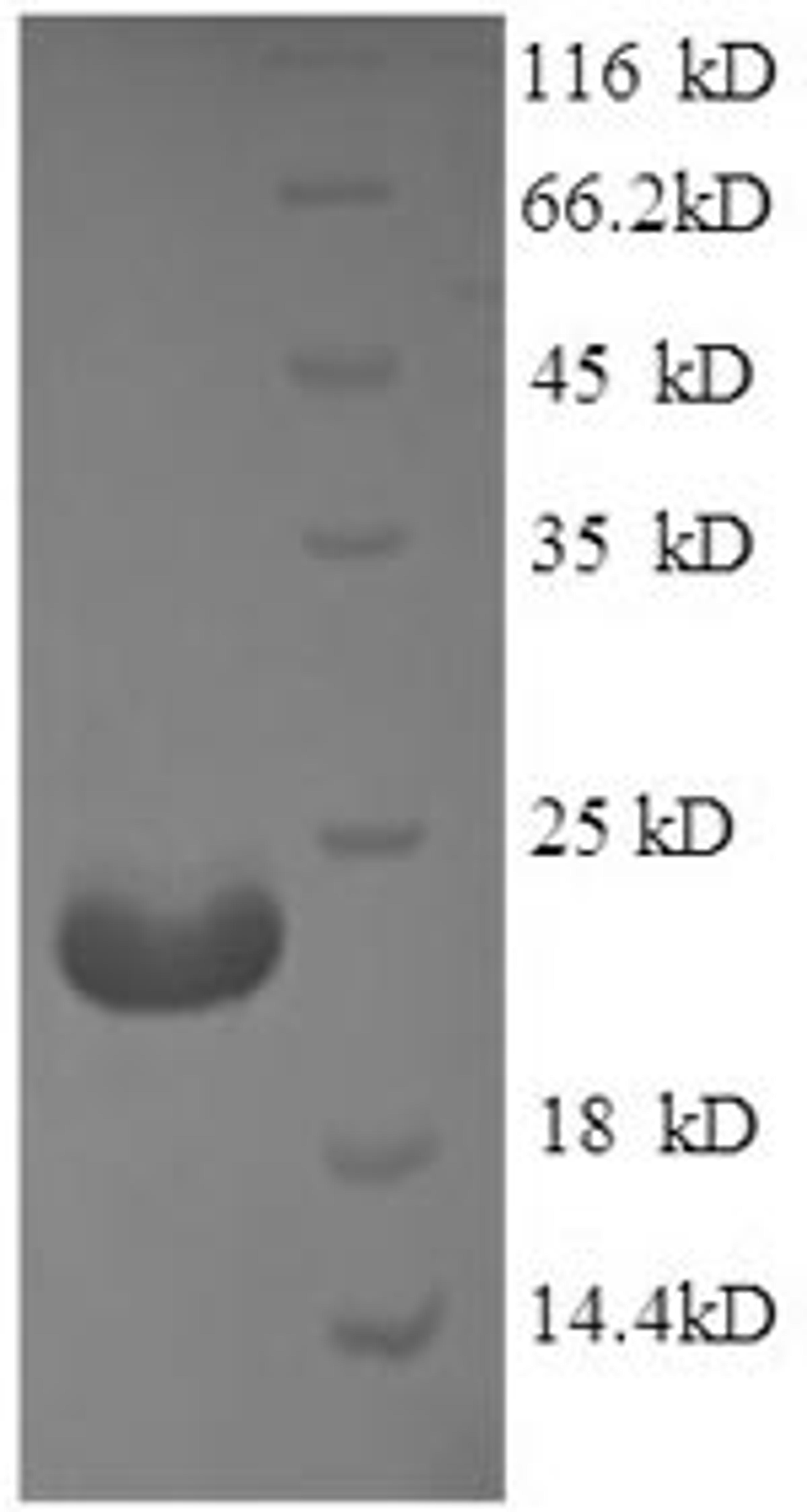 (Tris-Glycine gel) Discontinuous SDS-PAGE (reduced) with 5% enrichment gel and 15% separation gel.