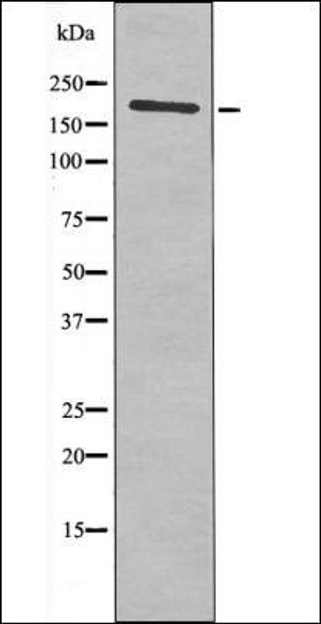 Western blot analysis of HeLa whole cell lysates using HER2 -Phospho-Thr686- antibody