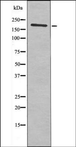 Western blot analysis of HeLa whole cell lysates using HER2 -Phospho-Thr686- antibody