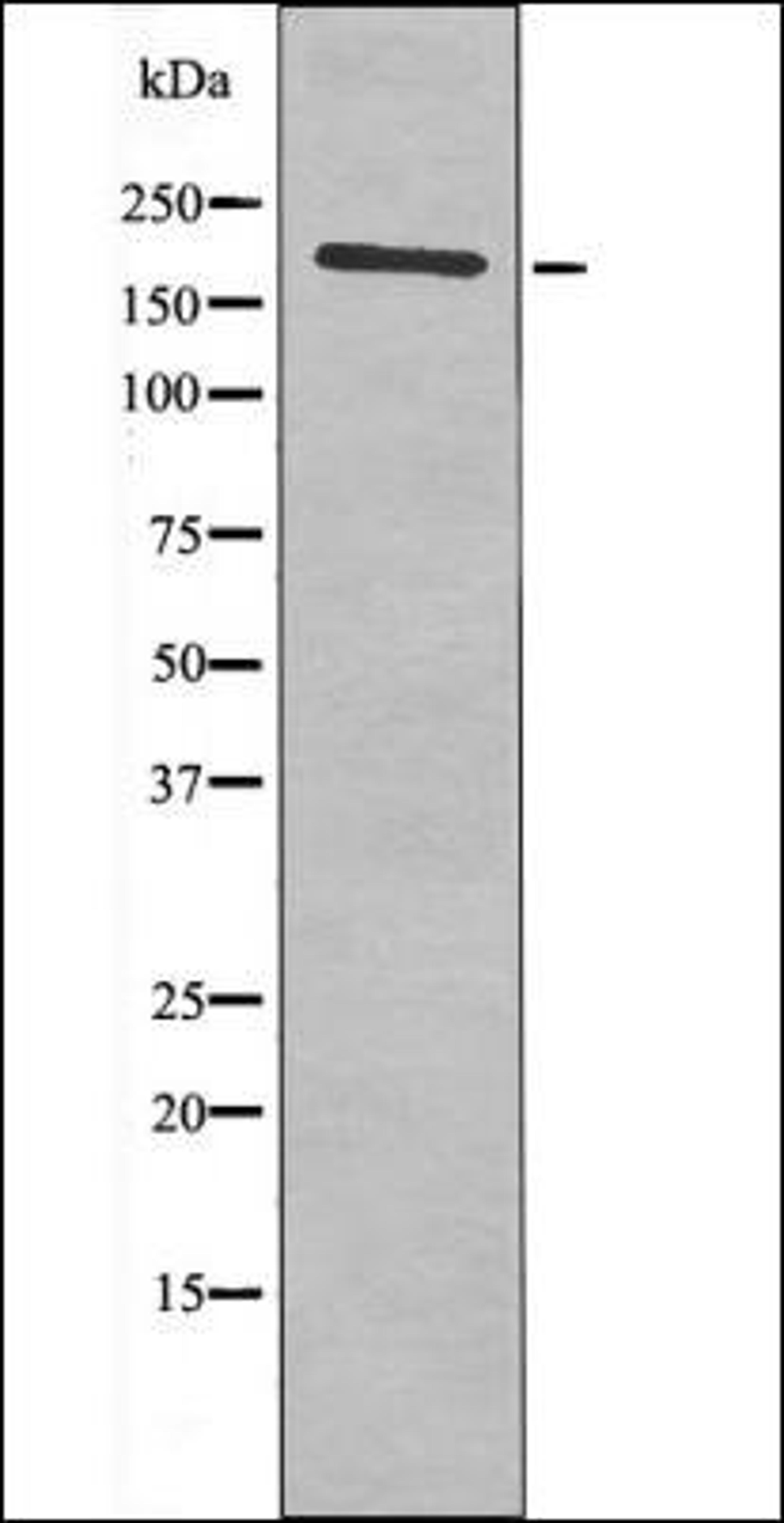 Western blot analysis of HeLa whole cell lysates using HER2 -Phospho-Thr686- antibody