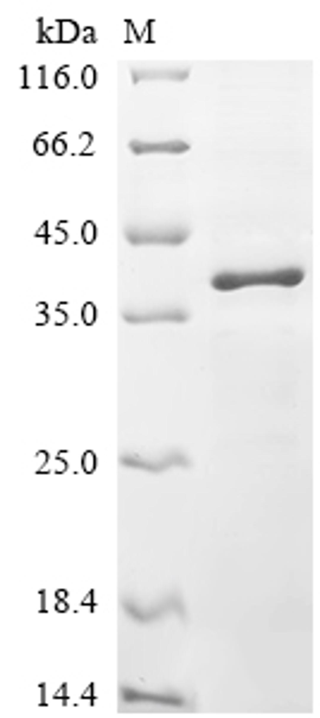 (Tris-Glycine gel) Discontinuous SDS-PAGE (reduced) with 5% enrichment gel and 15% separation gel.