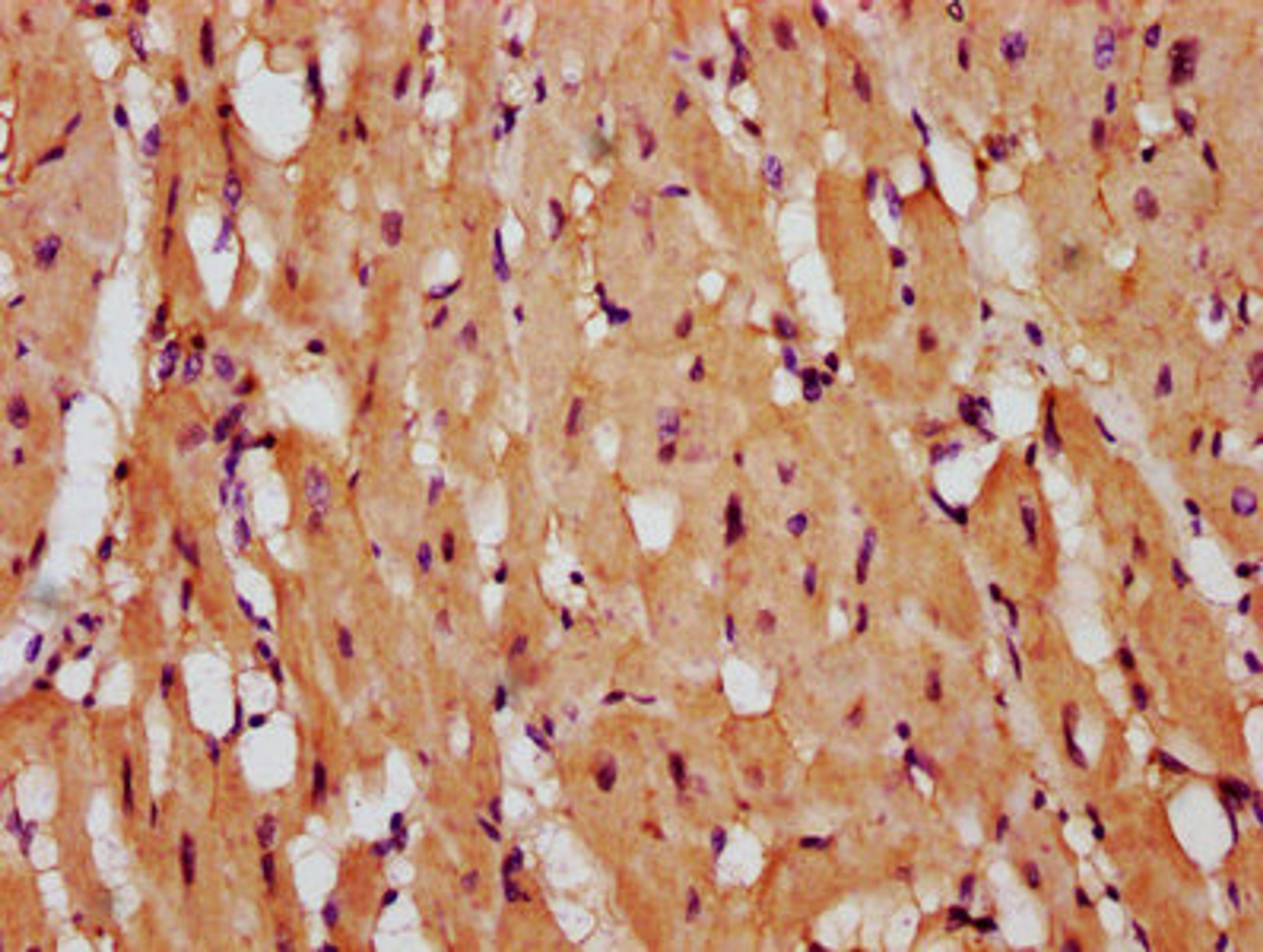 IHC image of CSB-PA613588LA01HU diluted at 1:400 and staining in paraffin-embedded human heart tissue performed on a Leica BondTM system. After dewaxing and hydration, antigen retrieval was mediated by high pressure in a citrate buffer (pH 6.0). Section was blocked with 10% normal goat serum 30min at RT. Then primary antibody (1% BSA) was incubated at 4&deg;C overnight. The primary is detected by a biotinylated secondary antibody and visualized using an HRP conjugated SP system.