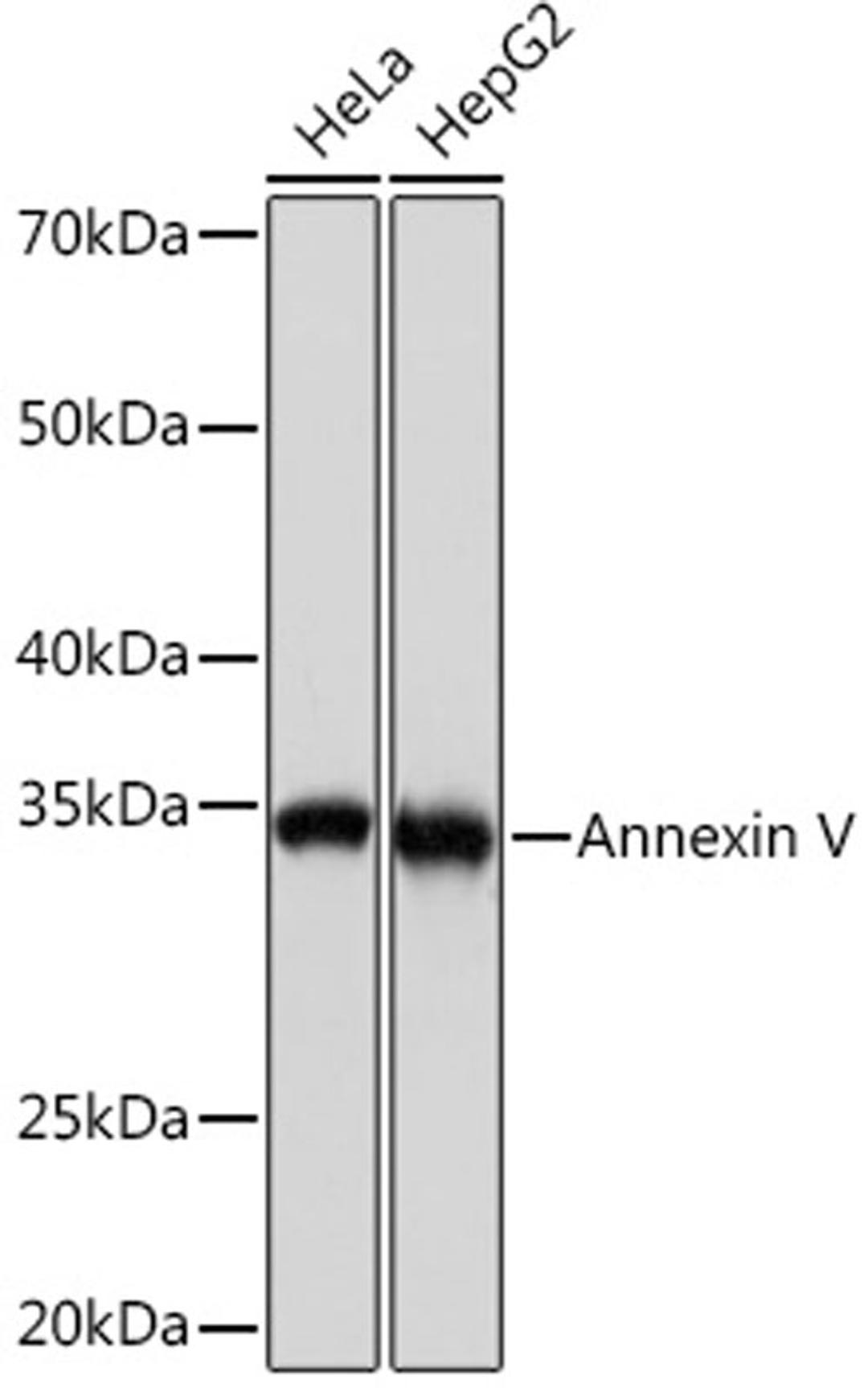 Western blot - Annexin V Rabbit mAb (A9262)