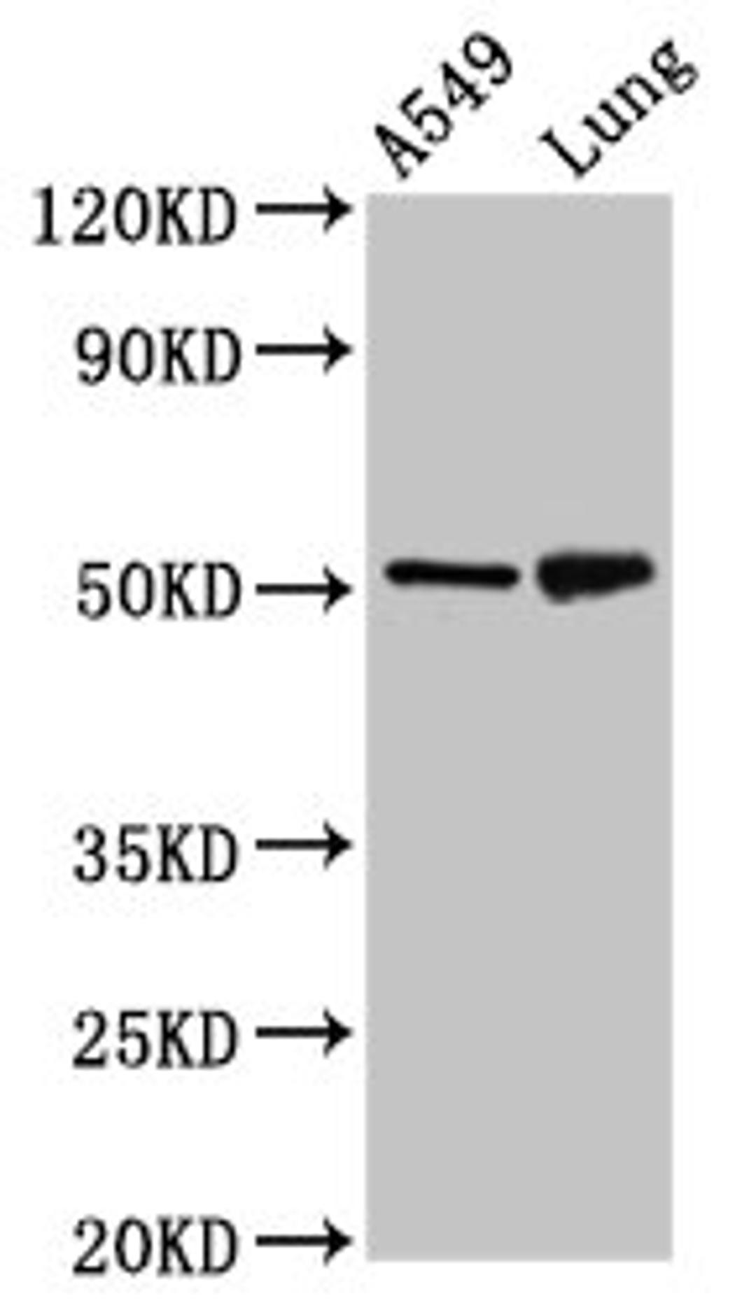 Western Blot. Positive WB detected in: A549 whole cell lysate, Rat lung tissue. All lanes: IRX3 antibody at 5ug/ml. Secondary. Goat polyclonal to rabbit IgG at 1/50000 dilution. Predicted band size: 53 kDa. Observed band size: 53 kDa.