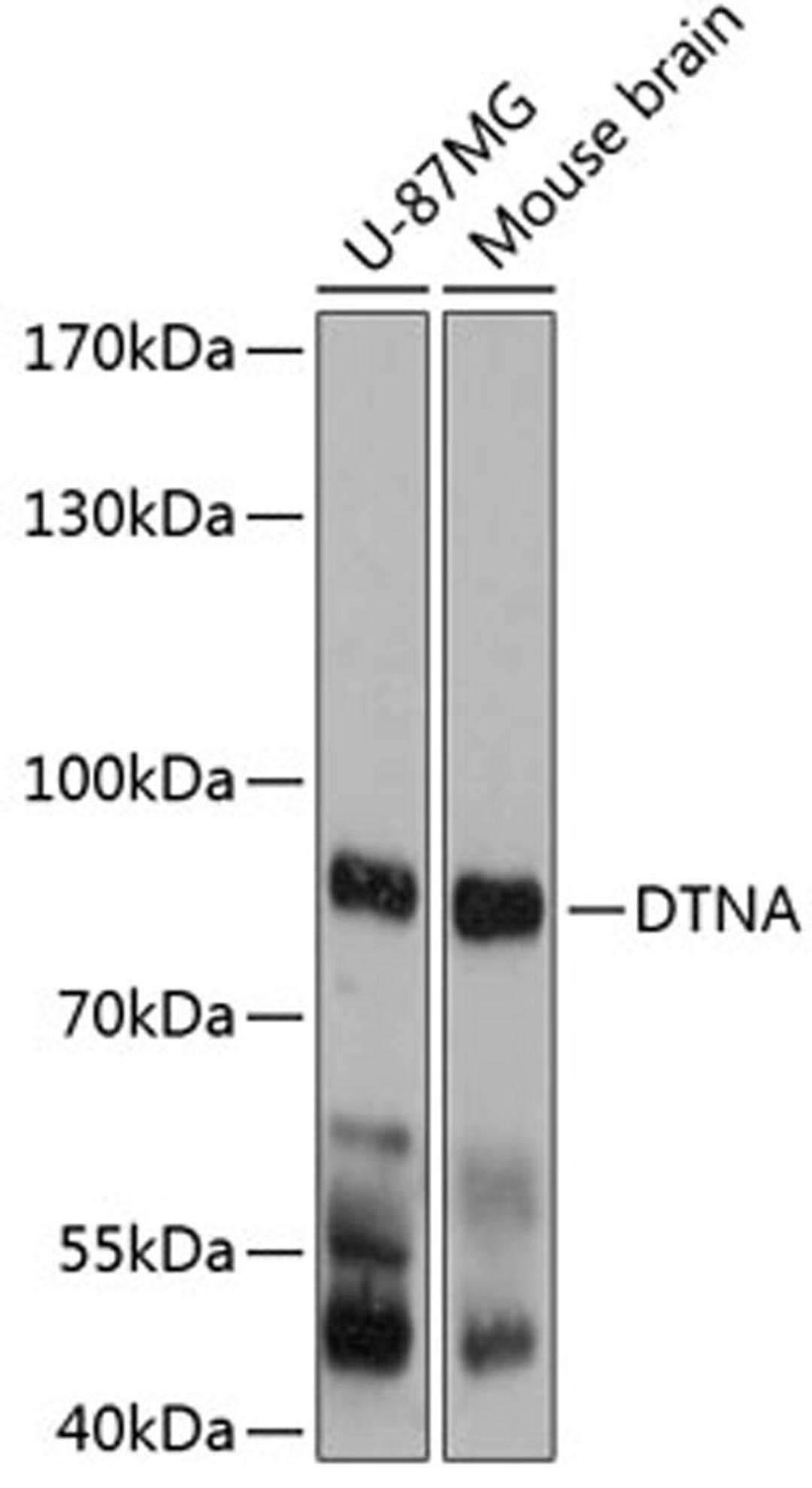 Western blot - DTNA antibody (A12067)