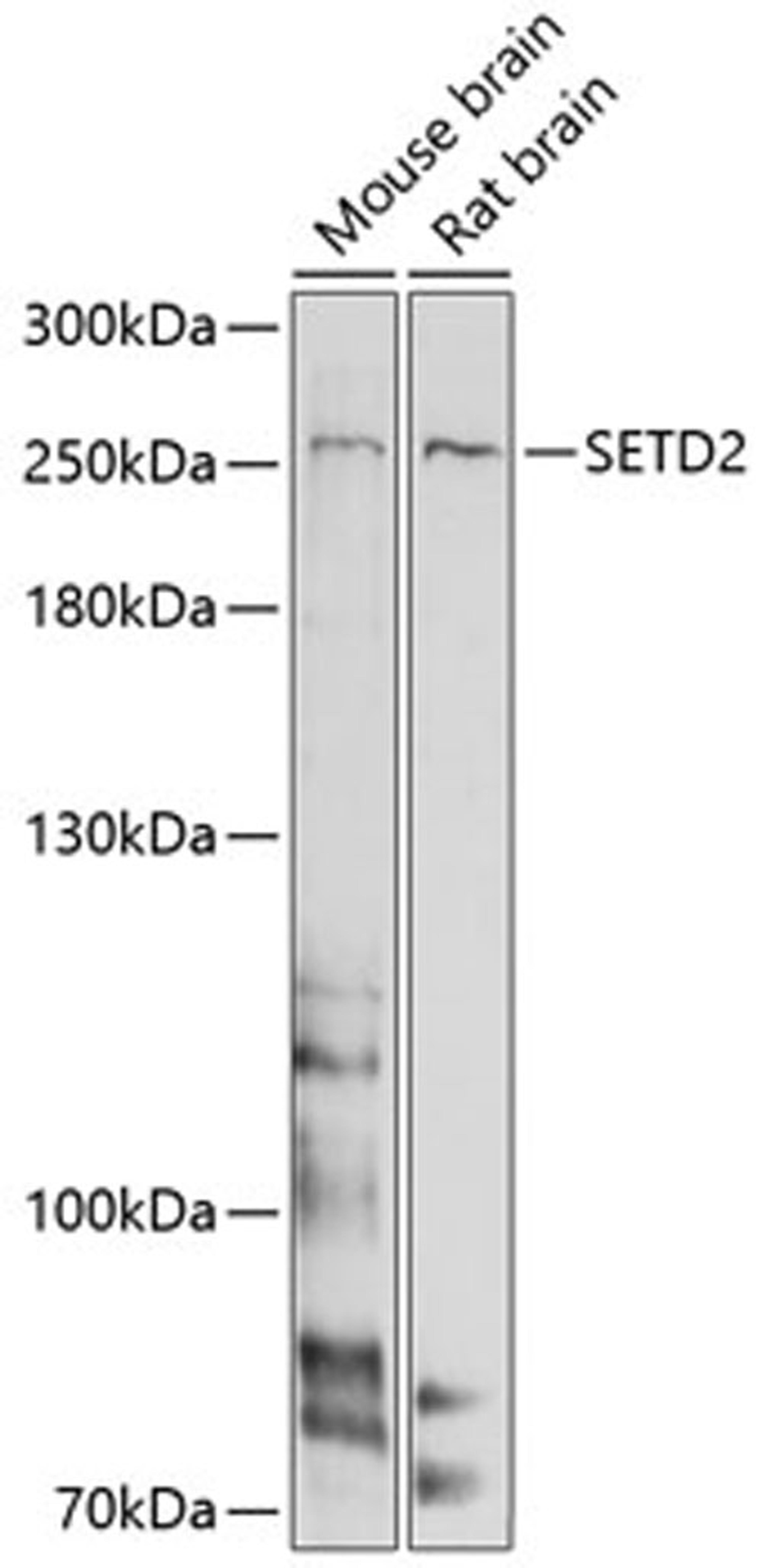 Western blot - SETD2 antibody (A11271)