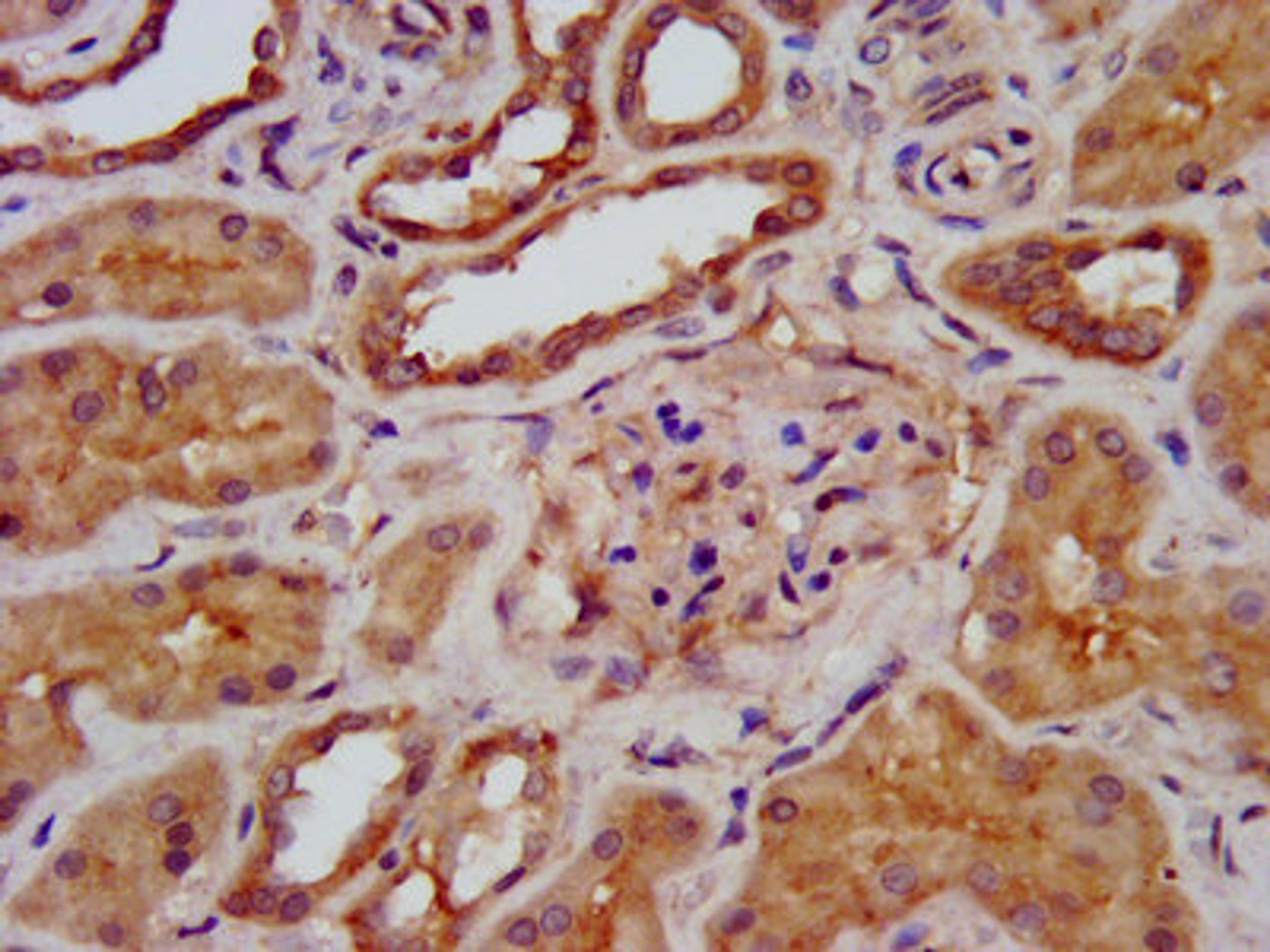 IHC image of CSB-PA871629LA01HU diluted at 1:400 and staining in paraffin-embedded human kidney tissue performed on a Leica BondTM system. After dewaxing and hydration, antigen retrieval was mediated by high pressure in a citrate buffer (pH 6.0). Section was blocked with 10% normal goat serum 30min at RT. Then primary antibody (1% BSA) was incubated at 4°C overnight. The primary is detected by a biotinylated secondary antibody and visualized using an HRP conjugated SP system.