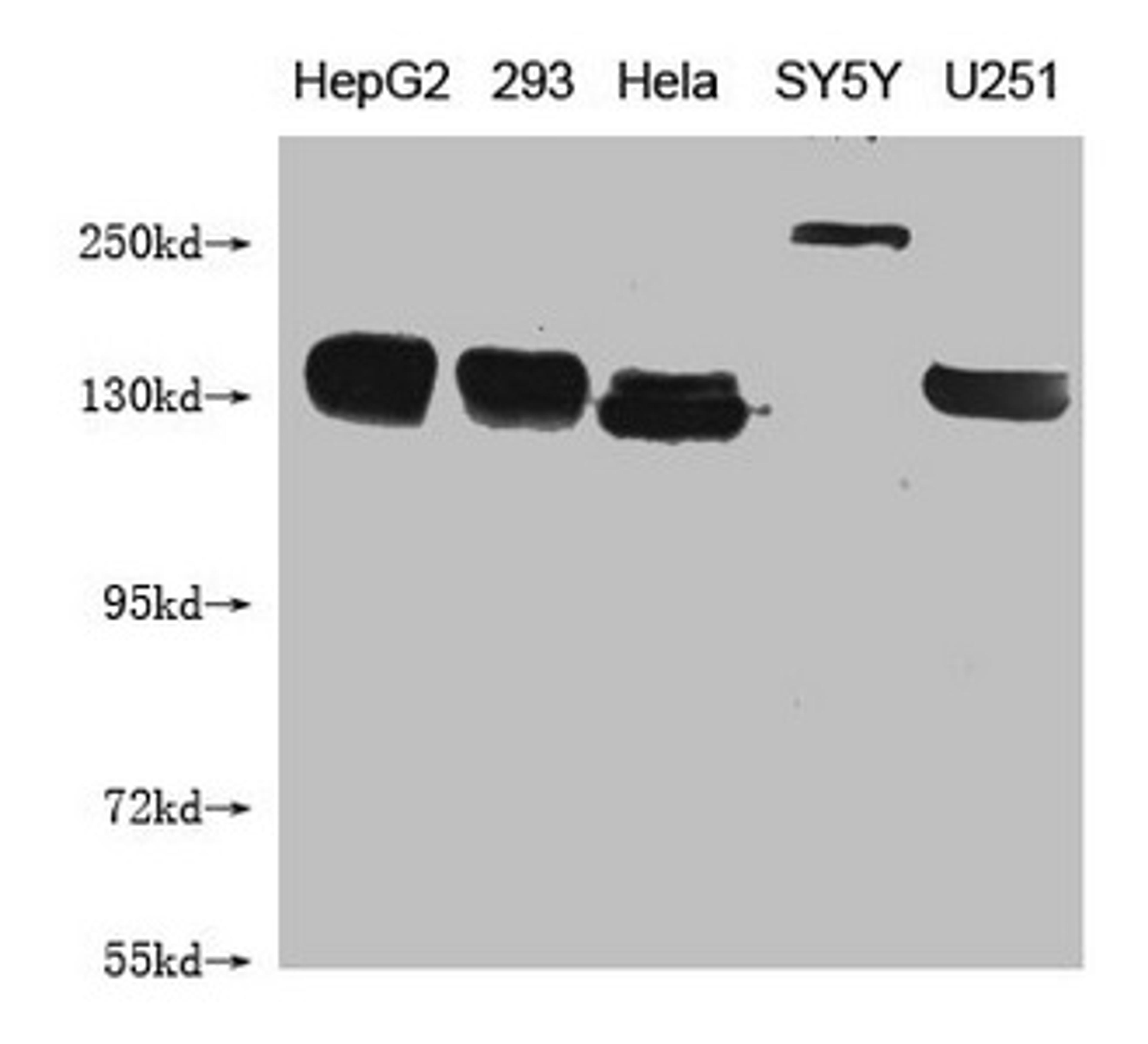 Western Blot. Positive WB detected in: HepG2 whole cell lysate, 293 whole cell lysate, Hela whole cell lysate, SY5Y whole cell lysate, U251 whole cell lysate . All lanes: ABCB1 antibody at 1:1000. Secondary. Goat polyclonal to mouse IgG at 1/50000 dilution. Predicted band size: 141 kDa. Observed band size: 141-250 KDa. Exposure time：5min