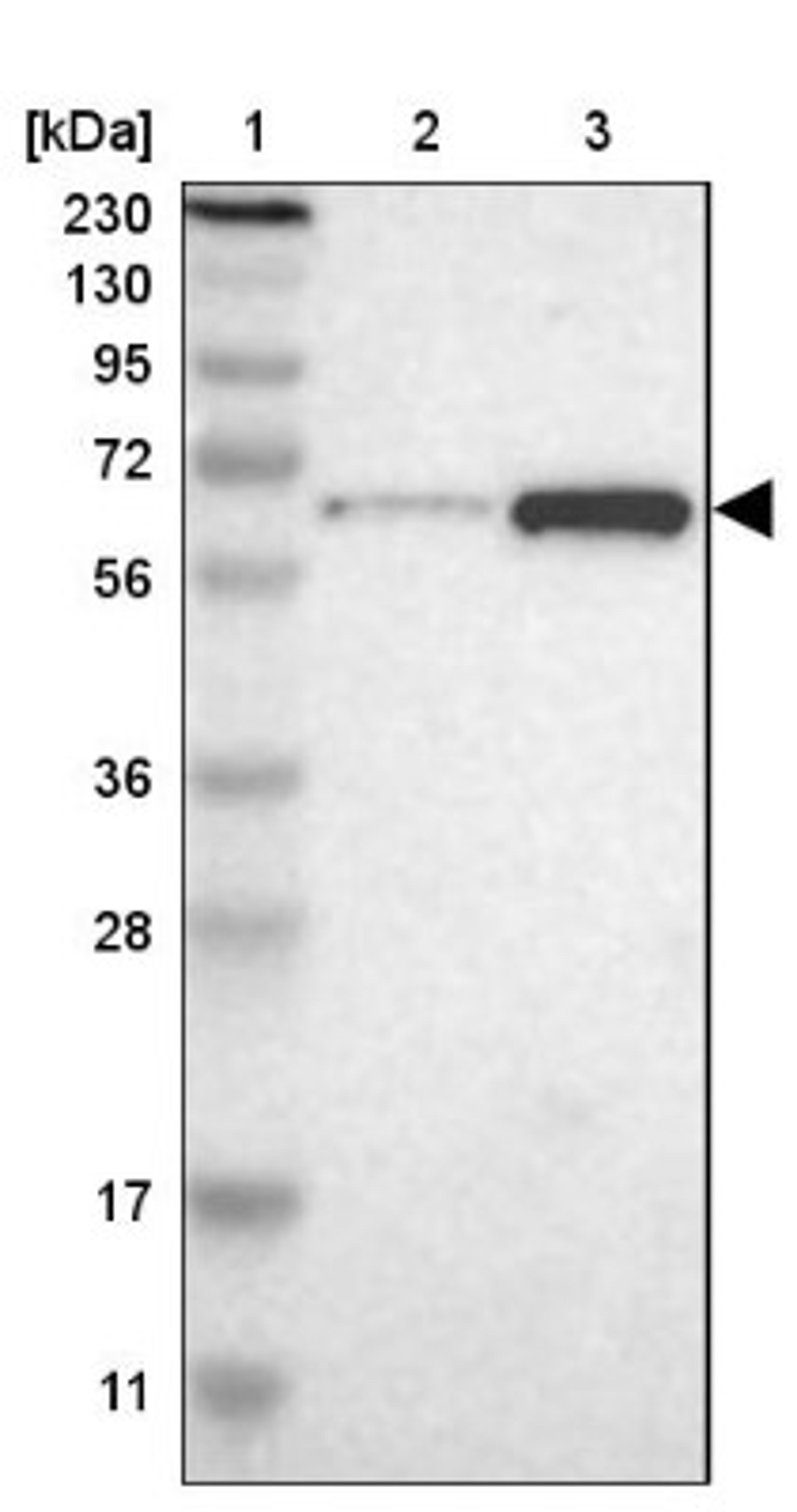 Western Blot: MEF2D Antibody [NBP1-85788] - Lane 1: Marker [kDa] 230, 130, 95, 72, 56, 36, 28, 17, 11<br/>Lane 2: Human cell line RT-4<br/>Lane 3: Human cell line U-251MG sp