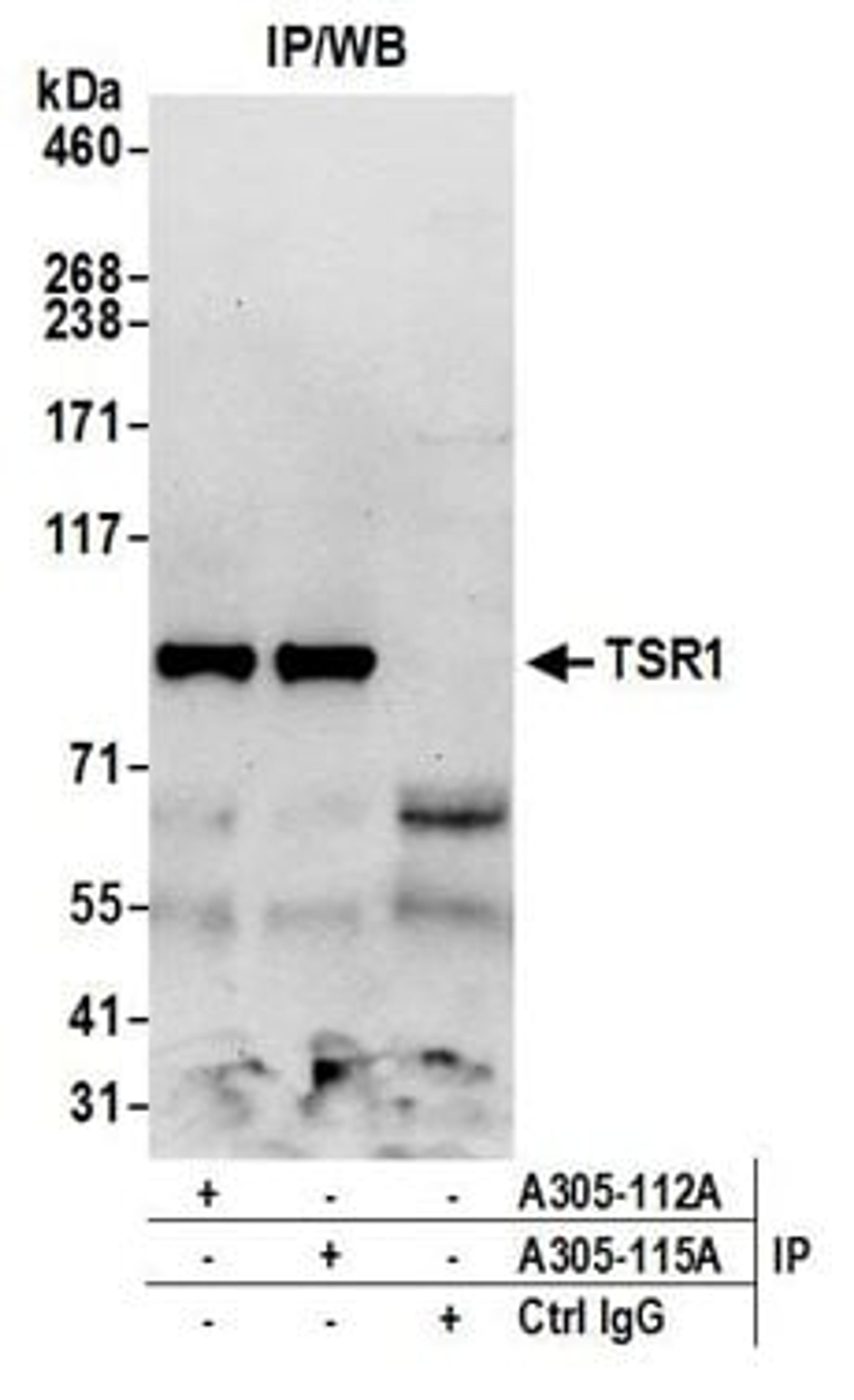 Detection of human TSR1 by western blot of immunoprecipitates.