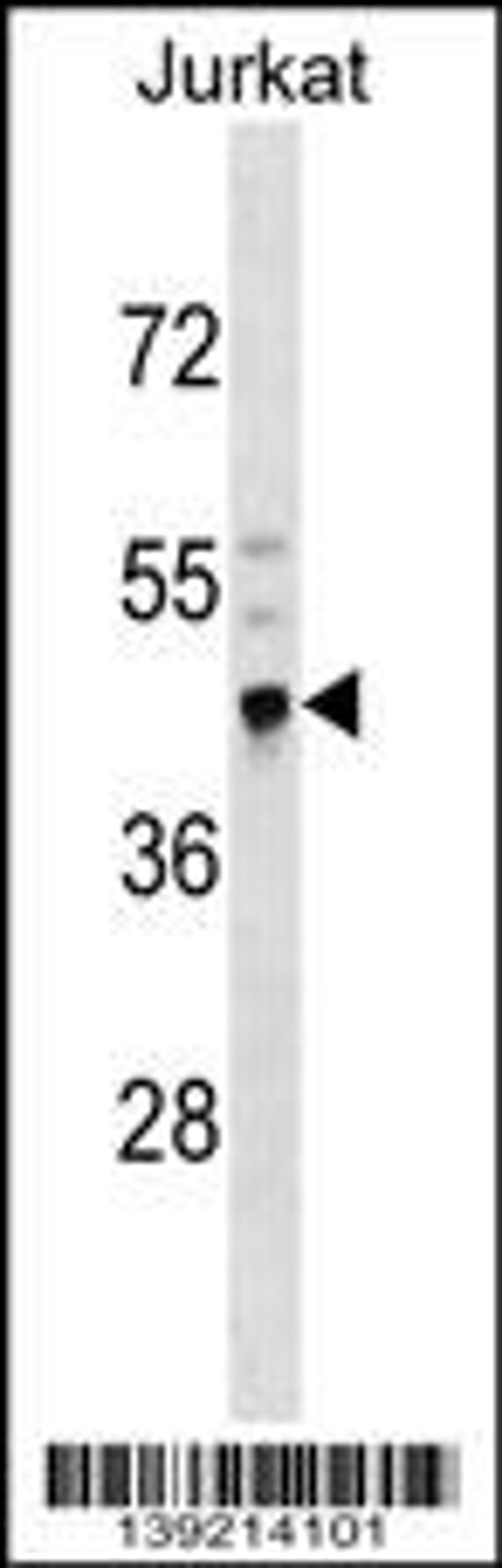 Western blot analysis in Jurkat cell line lysates (35ug/lane).