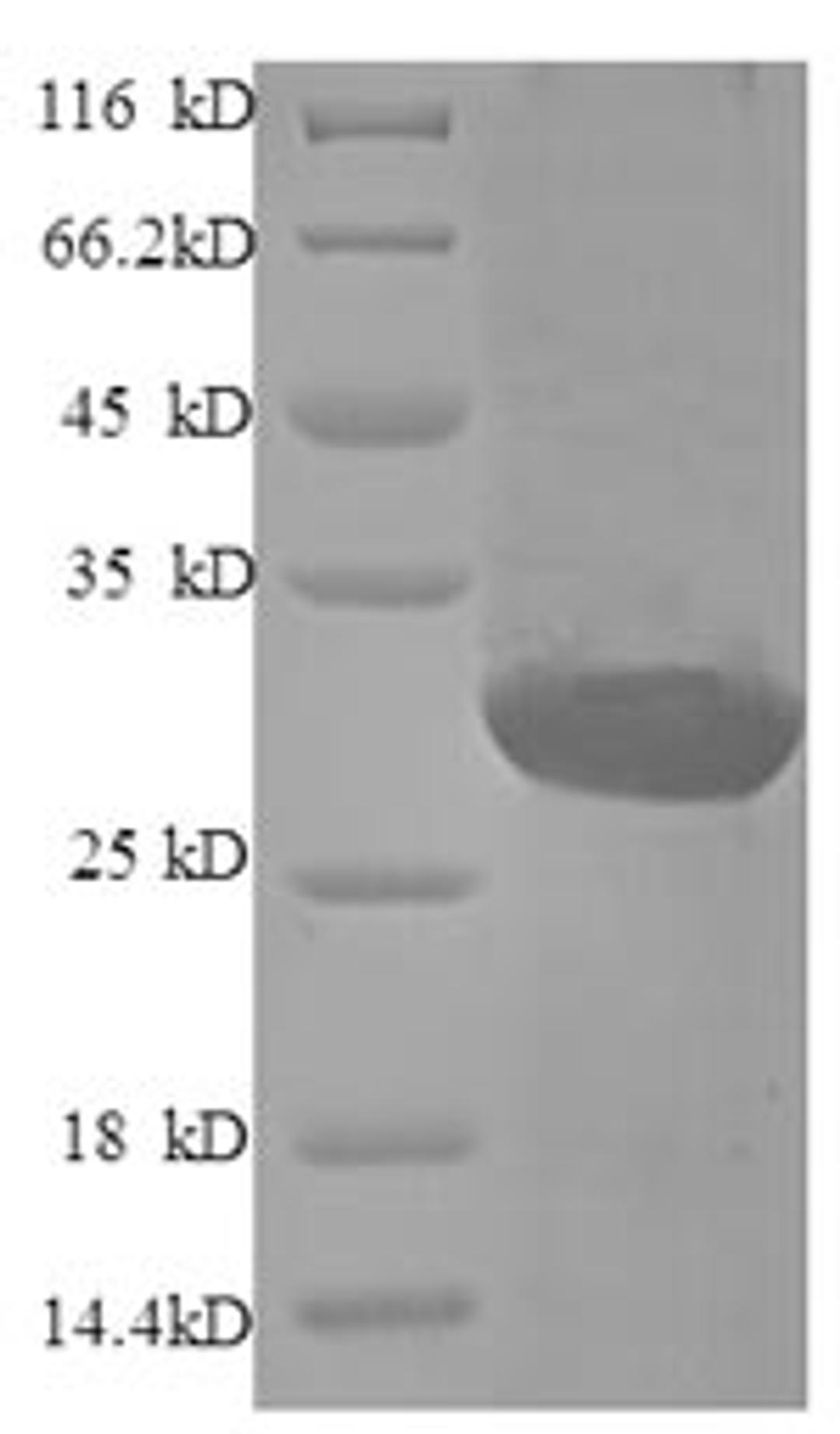 (Tris-Glycine gel) Discontinuous SDS-PAGE (reduced) with 5% enrichment gel and 15% separation gel.