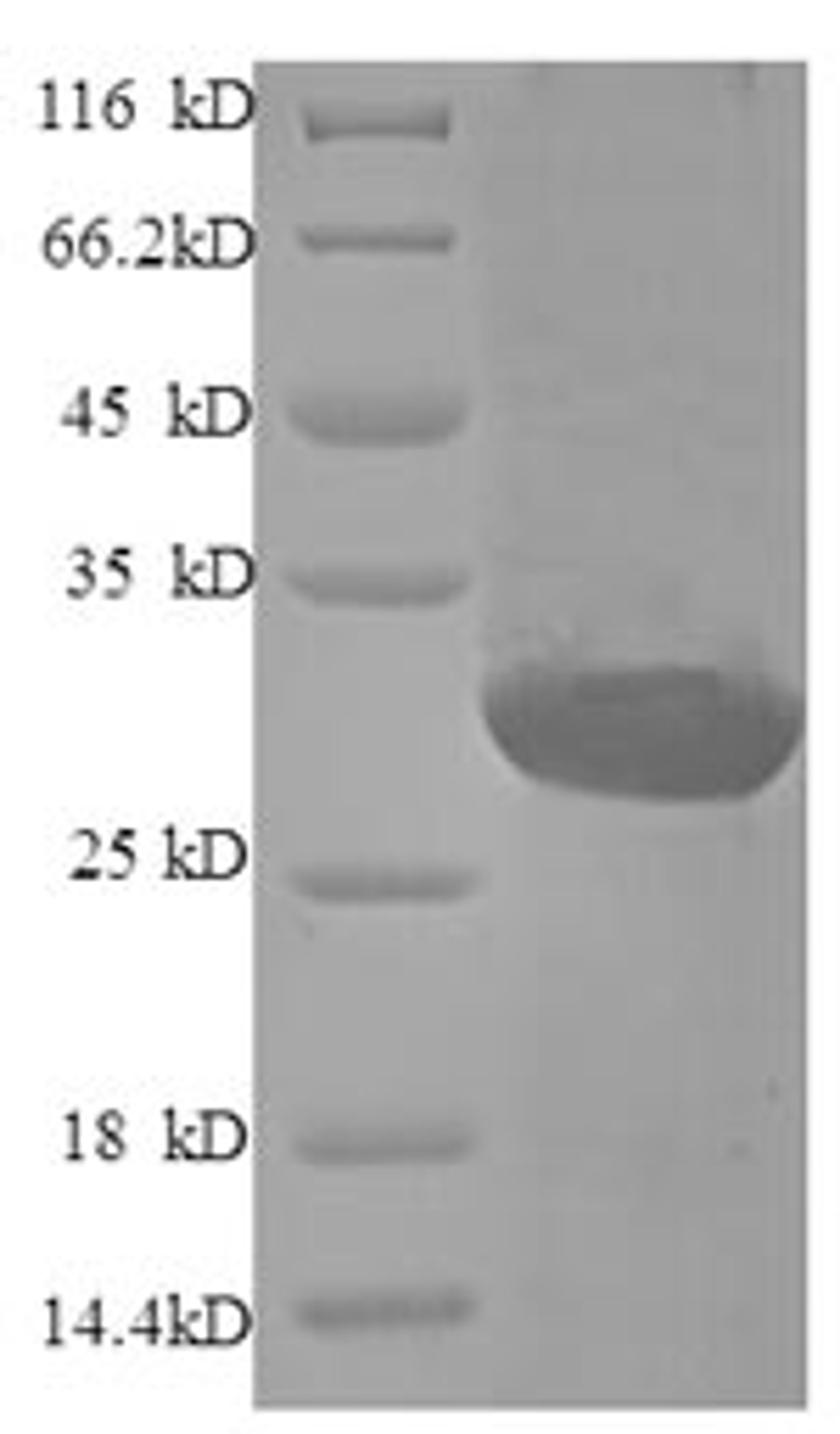 (Tris-Glycine gel) Discontinuous SDS-PAGE (reduced) with 5% enrichment gel and 15% separation gel.