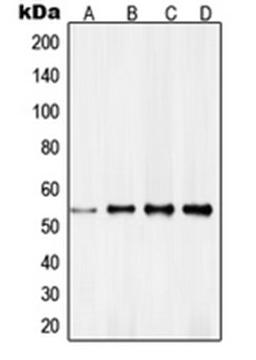 Western blot analysis of HeLa (Lane 1), NIH3T3 (Lane 2), MCF7 (Lane 3), A431 (Lane 4) whole cell lysates using RXRG antibody