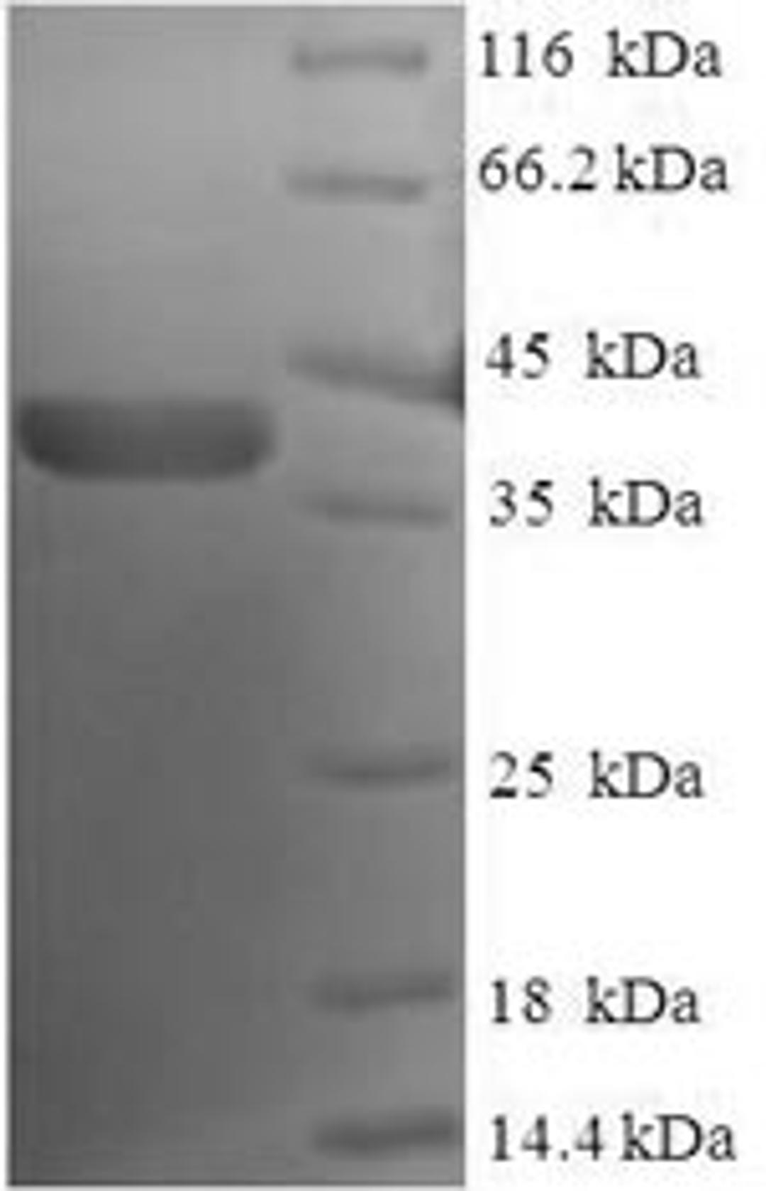(Tris-Glycine gel) Discontinuous SDS-PAGE (reduced) with 5% enrichment gel and 15% separation gel.