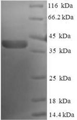 (Tris-Glycine gel) Discontinuous SDS-PAGE (reduced) with 5% enrichment gel and 15% separation gel.