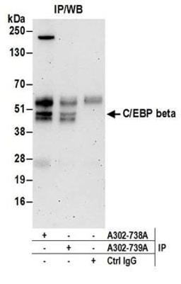 Detection of human C/EBP beta by western blot of immunoprecipitates.