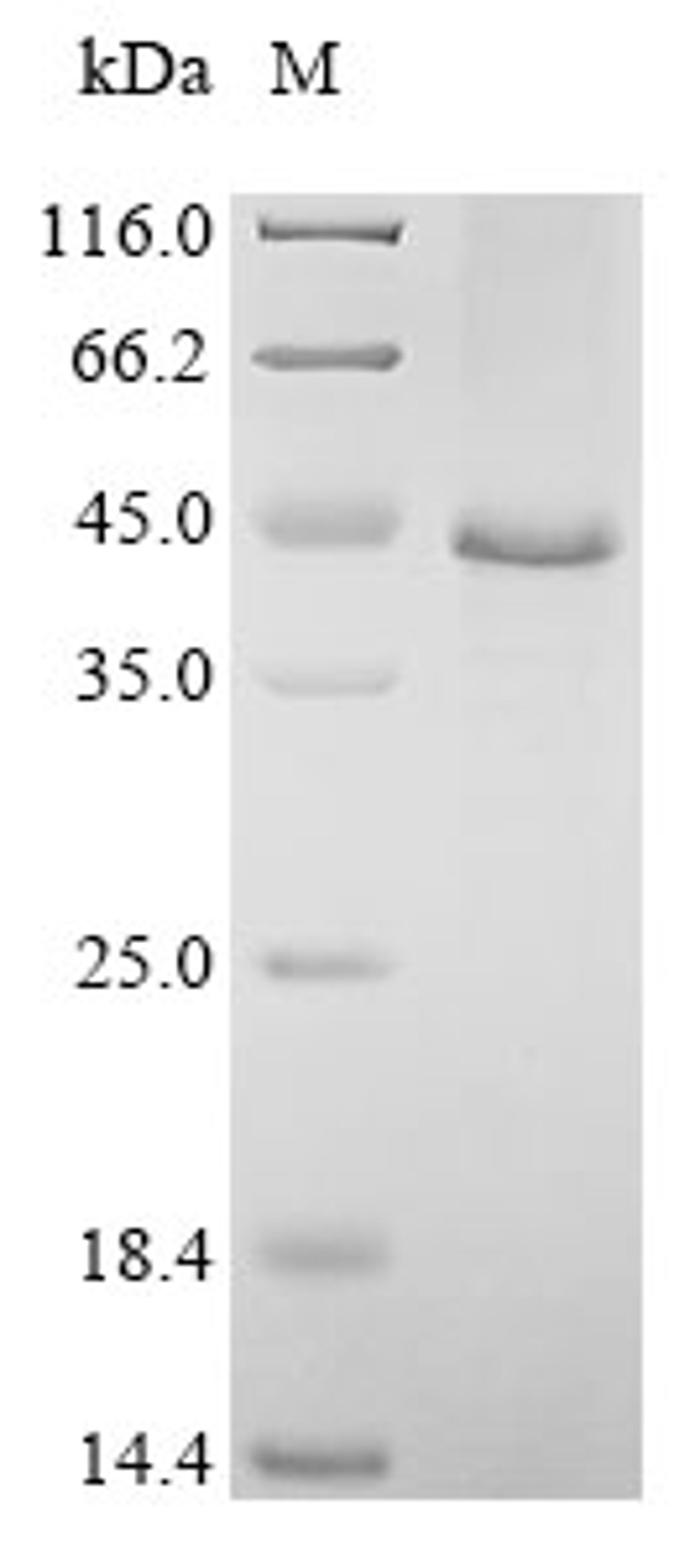 (Tris-Glycine gel) Discontinuous SDS-PAGE (reduced) with 5% enrichment gel and 15% separation gel.