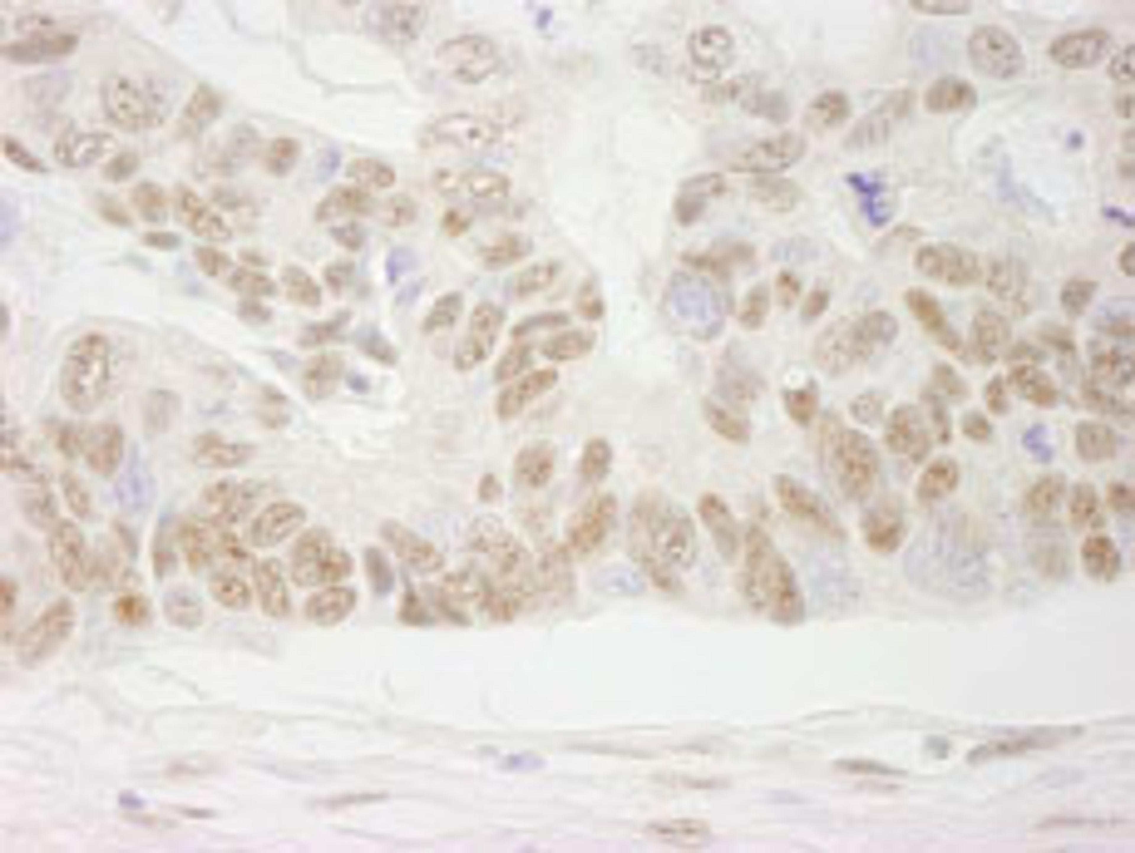 Detection of human COBRA1 by immunohistochemistry.