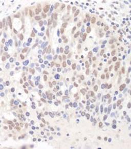 Detection of human DGCR8 by immunohistochemistry.