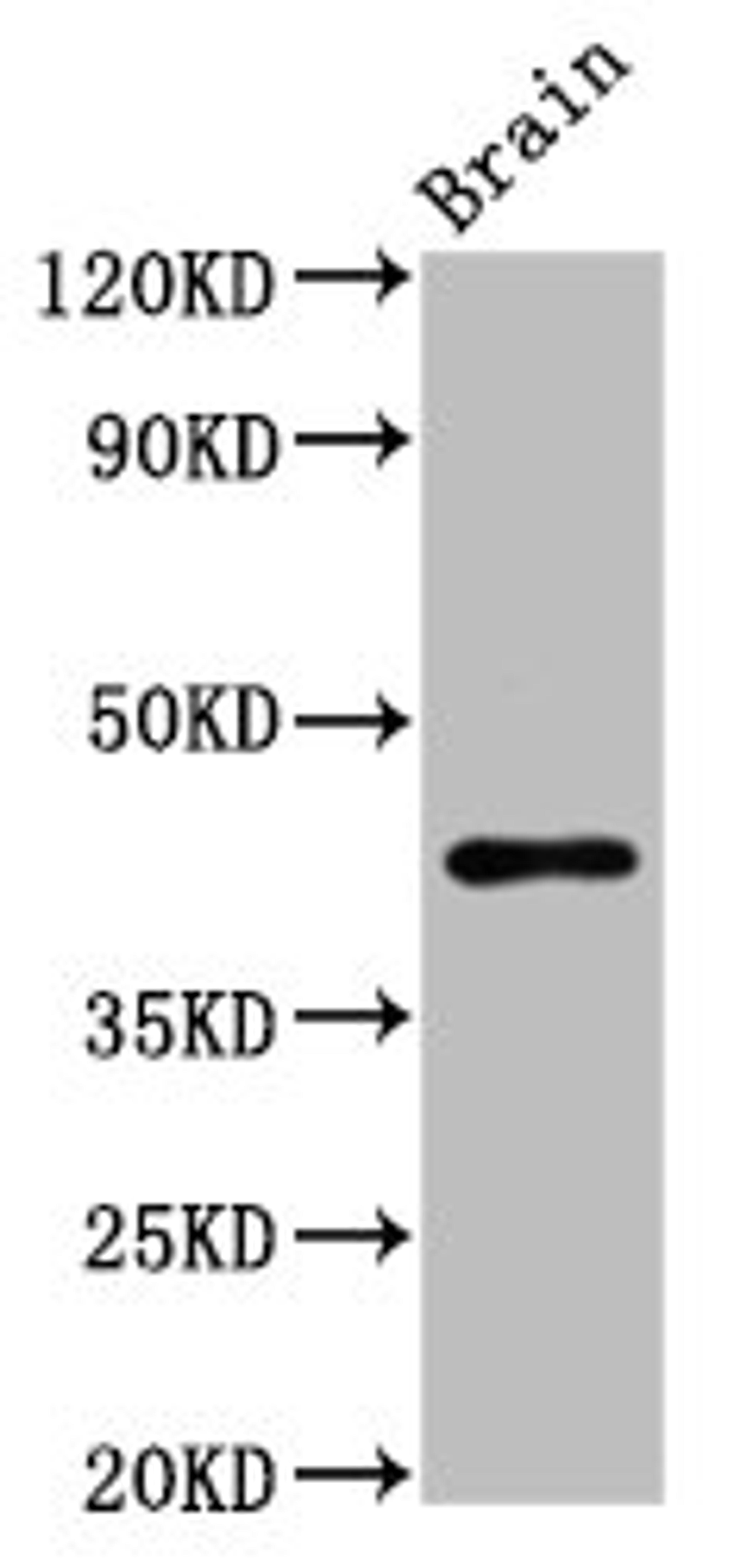 Western Blot. Positive WB detected in: Rat brain tissue. All lanes: METAP1 antibody at 6.2ug/ml. Secondary. Goat polyclonal to rabbit IgG at 1/50000 dilution. Predicted band size: 44 kDa. Observed band size: 44 kDa.