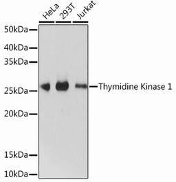 Western blot - Thymidine Kinase 1 Rabbit mAb (A13612)