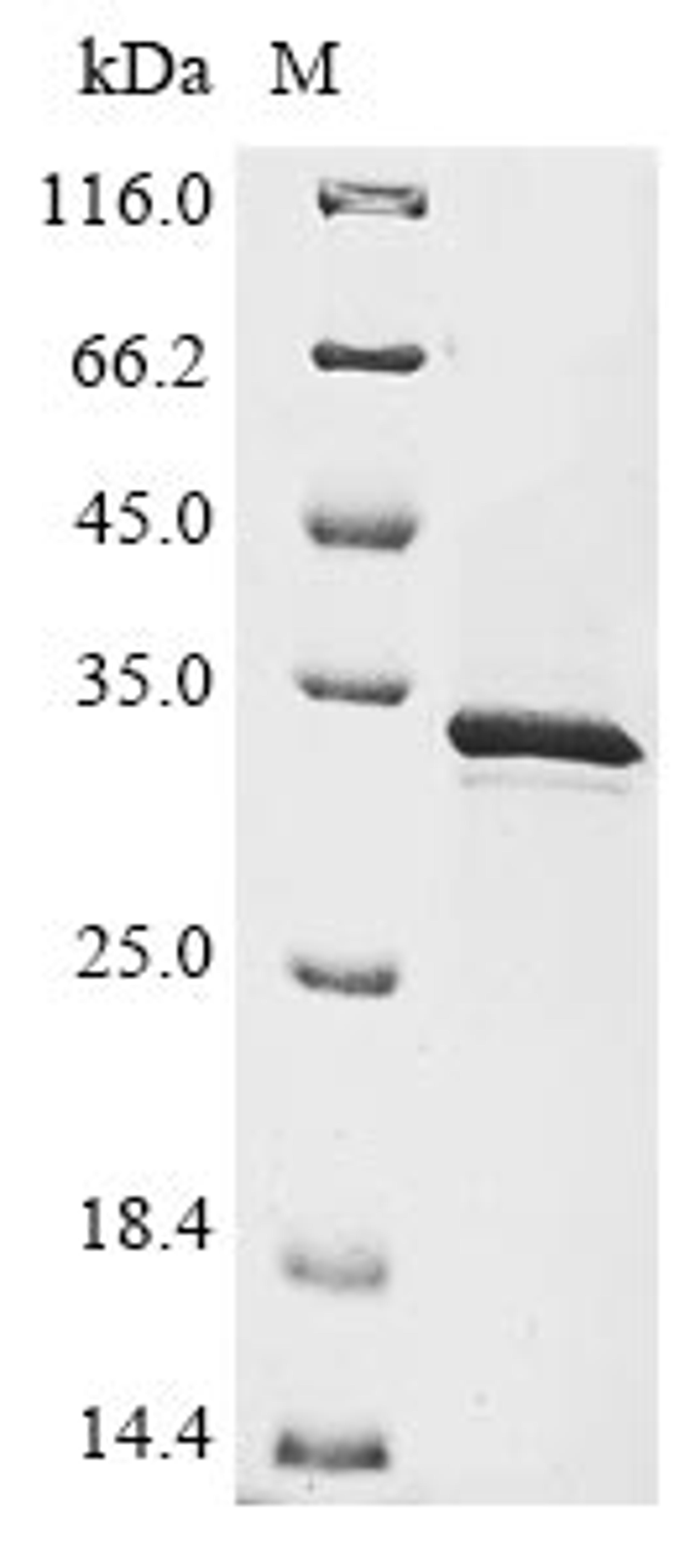 (Tris-Glycine gel) Discontinuous SDS-PAGE (reduced) with 5% enrichment gel and 15% separation gel.