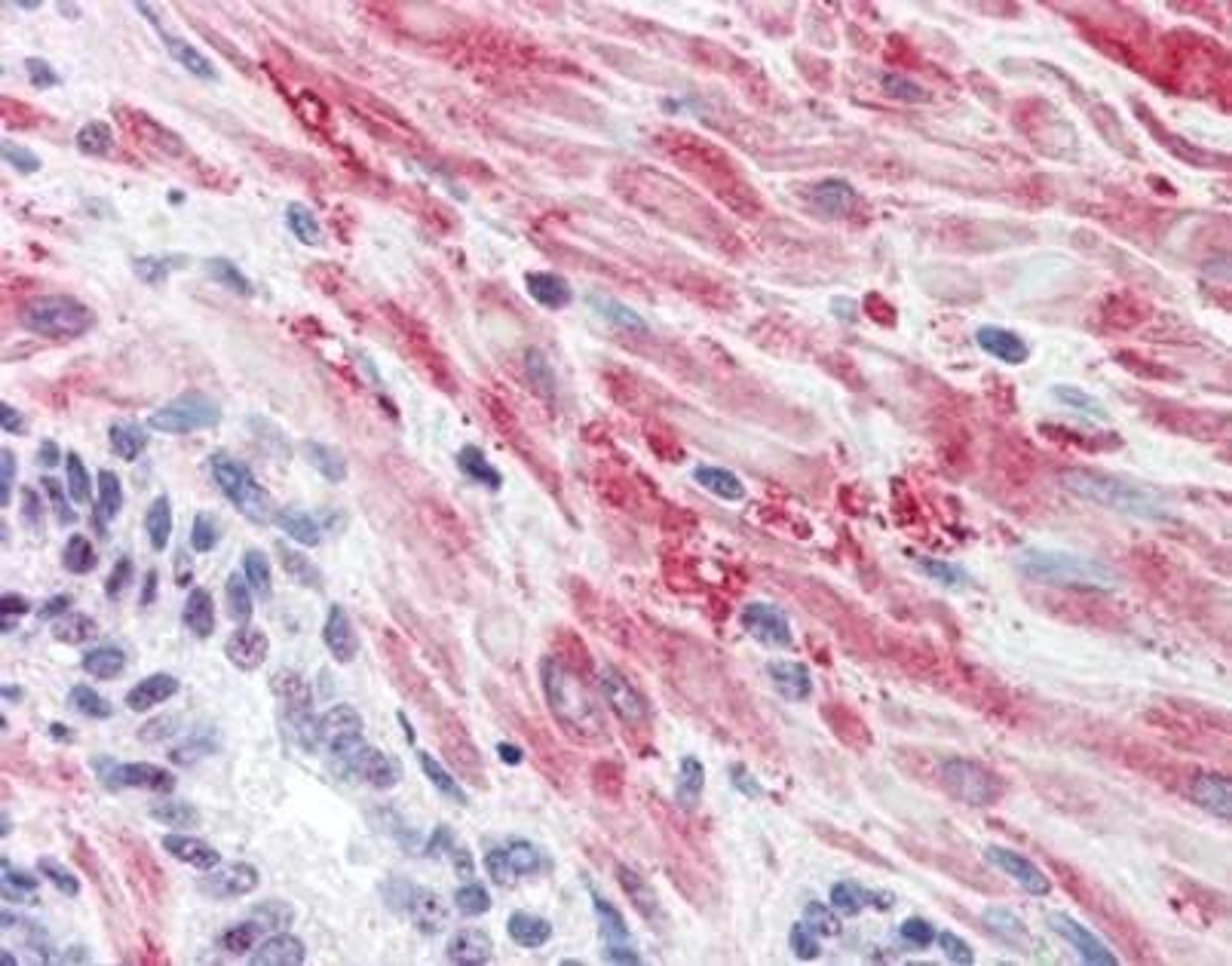 Immunohistochemical staining of Human Prostate tissue using Muscle Glycogen Synthase (phospho-S641) antibody