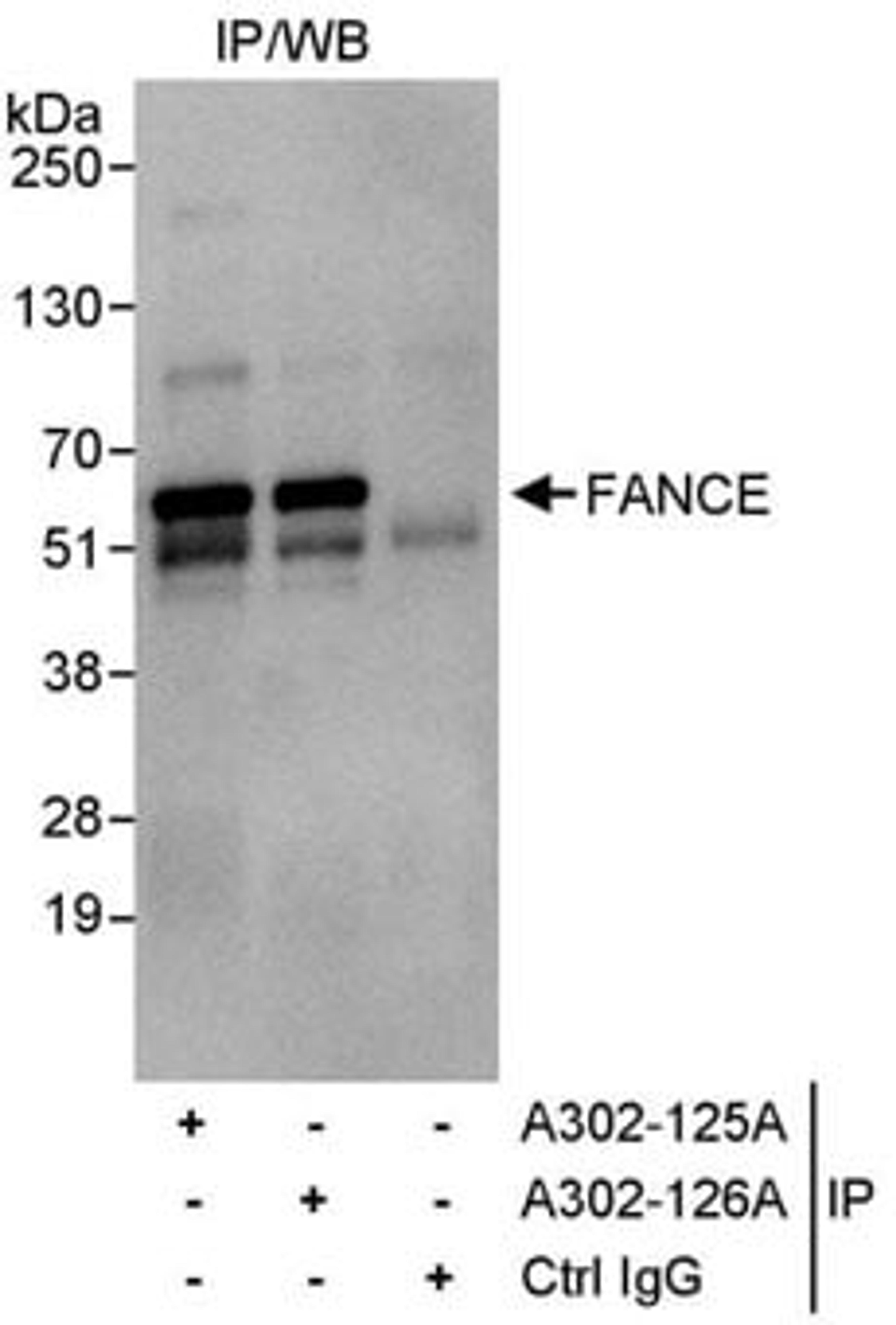 Detection of human FANCE by western blot of immunoprecipitates.