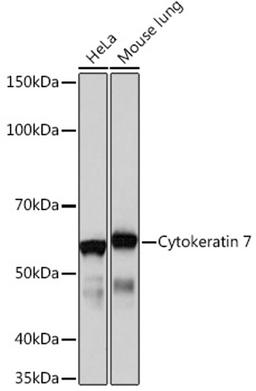 Western blot - Cytokeratin 7 Rabbit mAb (A4357)