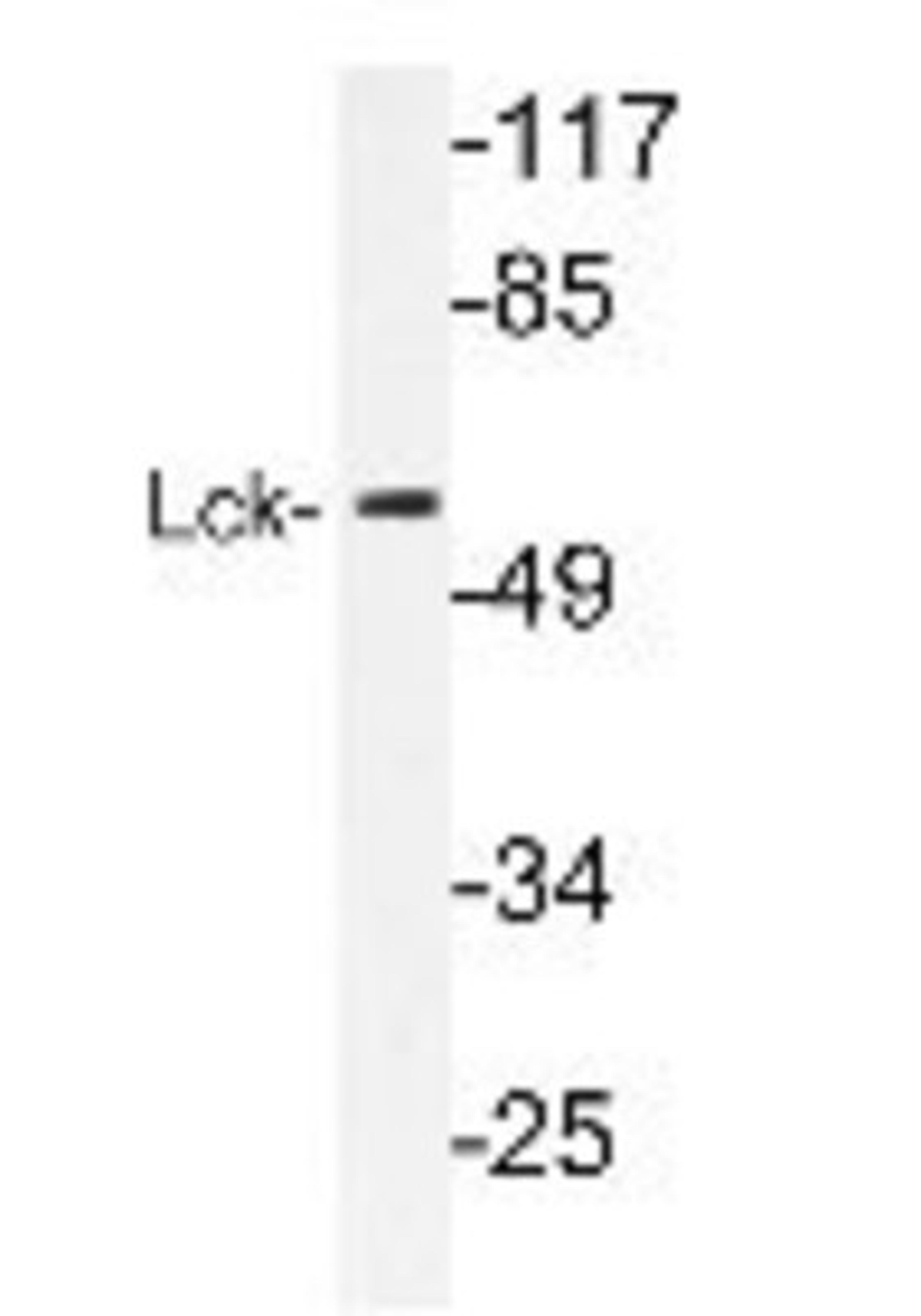 Western Blot: Lck Antibody [NBP1-19840] - extracts from 293 cells.