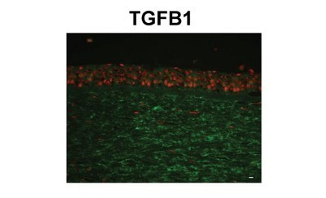 Immunohistochemistry-Paraffin: Beta Ig-h3/TGFBI Antibody [NBP1-60049] - human corneal tissue (epithelium and stroma) Primary 1:400 Secondary: Fluorescein Isothiocyanate-conjugated anti-rabbit IgG 1:350