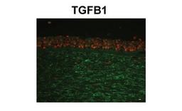 Immunohistochemistry-Paraffin: Beta Ig-h3/TGFBI Antibody [NBP1-60049] - human corneal tissue (epithelium and stroma) Primary 1:400 Secondary: Fluorescein Isothiocyanate-conjugated anti-rabbit IgG 1:350