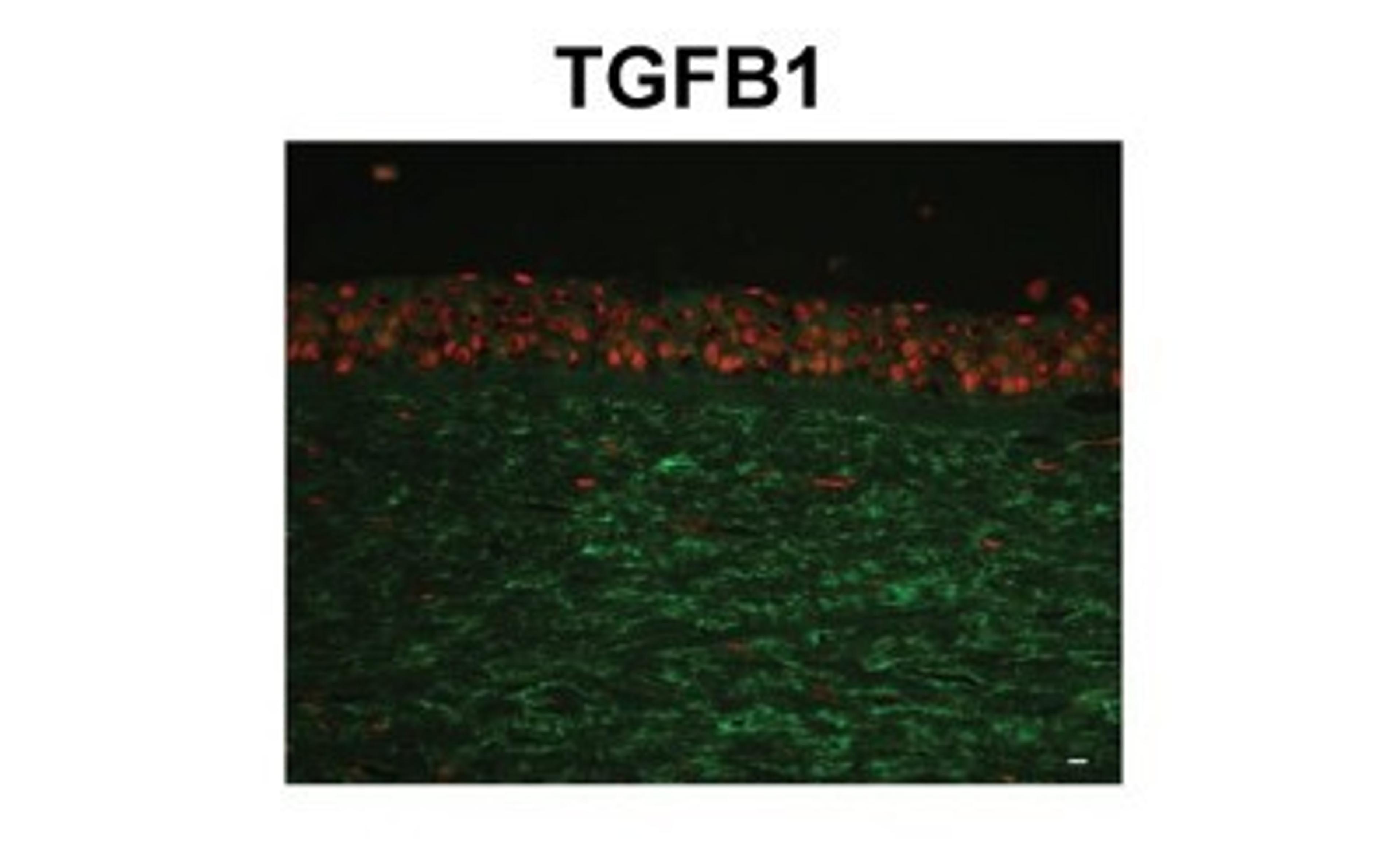 Immunohistochemistry-Paraffin: Beta Ig-h3/TGFBI Antibody [NBP1-60049] - human corneal tissue (epithelium and stroma) Primary 1:400 Secondary: Fluorescein Isothiocyanate-conjugated anti-rabbit IgG 1:350