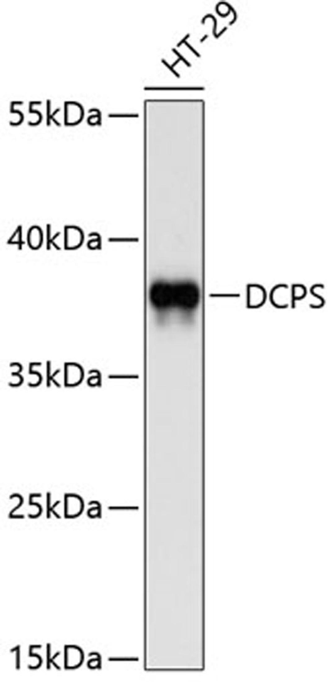 Western blot - DCPS antibody (A10299)