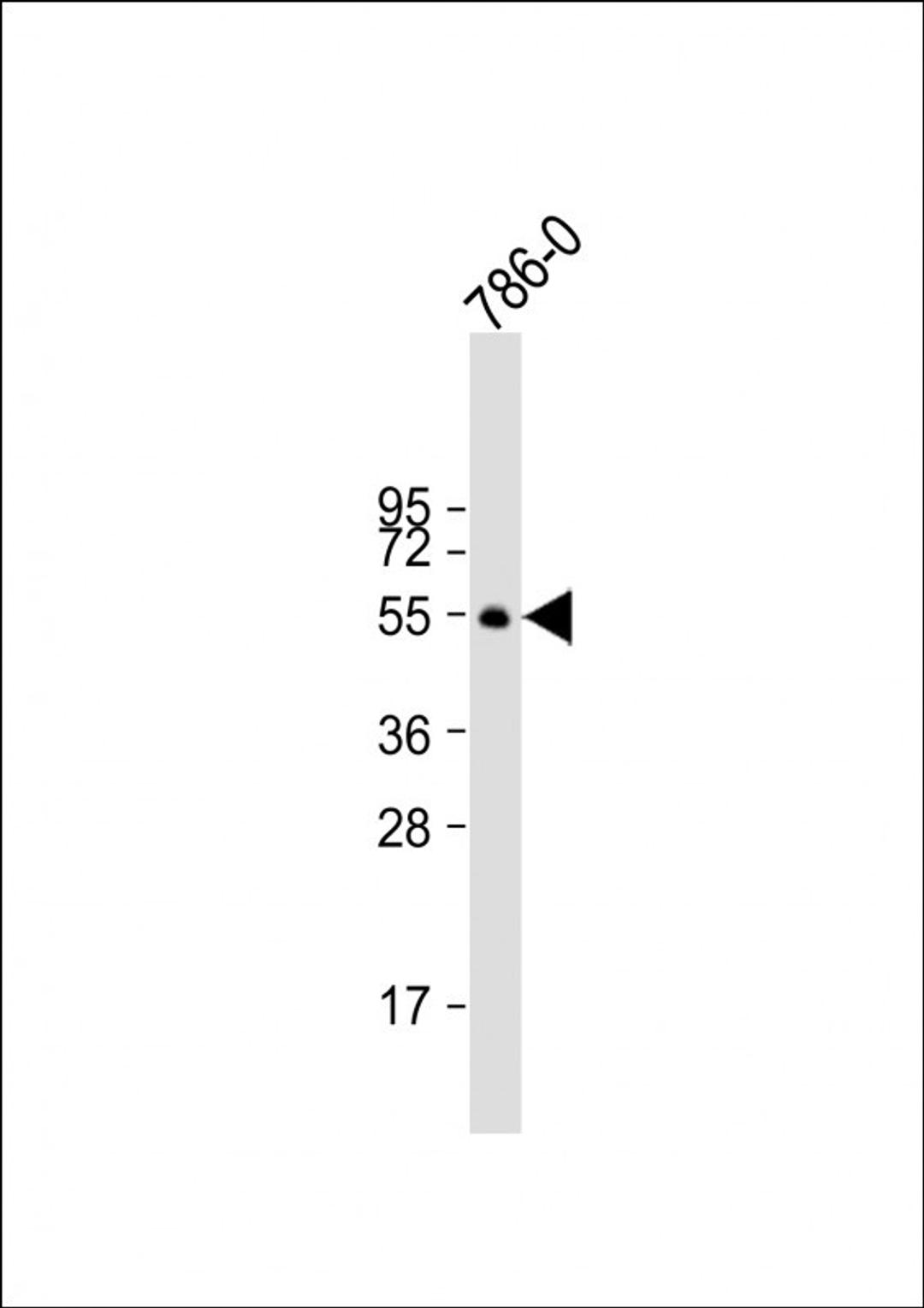 Western Blot at 1:2000 dilution + 786-0 whole cell lysate Lysates/proteins at 20 ug per lane.