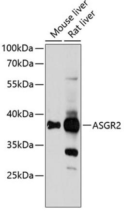 Western blot - ASGR2 Antibody (A13949)