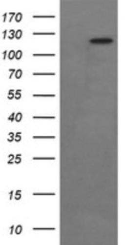 Western Blot: FAK Antibody (4D11) [NBP2-45923] - Analysis of HEK293T cells were transfected with the pCMV6-ENTRY control (Left lane) or pCMV6-ENTRY FAK .