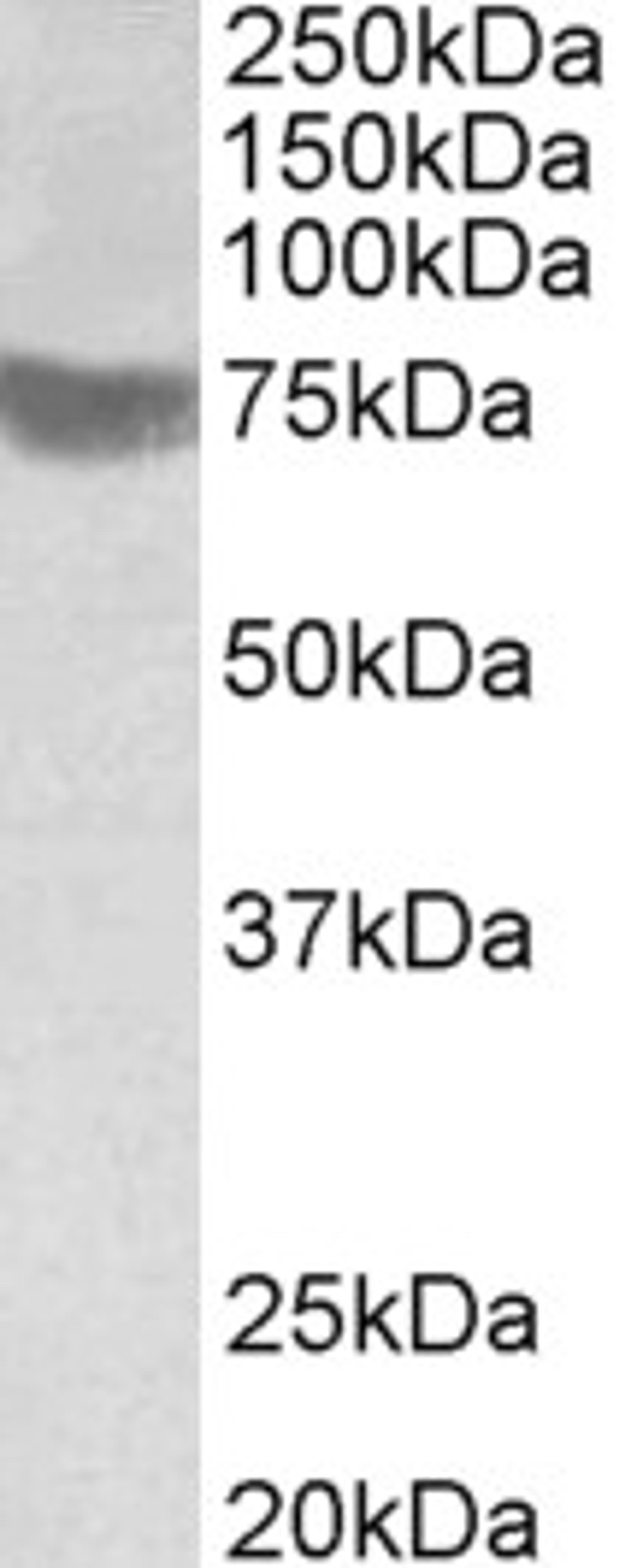 46-933 (1ug/ml) staining of Human Skeletal Muscle lysate (35ug protein in RIPA buffer). Primary incubation was 1 hour. Detected by chemiluminescence.